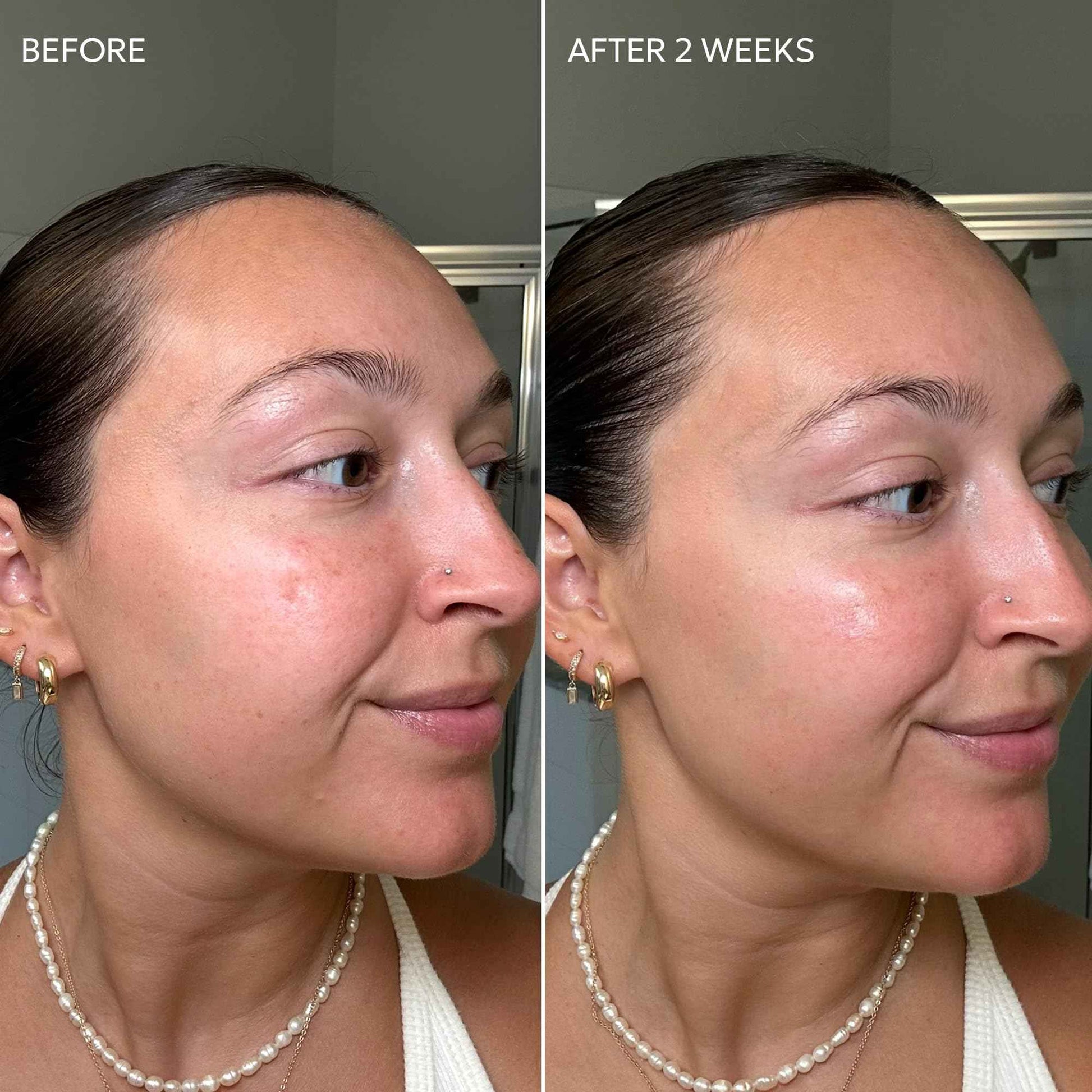 Dermisa Skin Fade Cream with Antioxidant Vitamin C | Helps Reduce Appearance of Dark Spots, Freckles, Marks from Acne, Aging, and Use of Birth Control | Light Non-Greasy & Quick Absorbing Cream | 1.78 OZ | Pack of 3