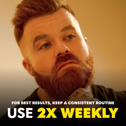 Beard Club Premium Derma Roller & Beard Growth Oil - Microneedling Roller with 540 Titanium Microneedles for Face, Body and Scalp - Beard Roller with Sandalwood & Cedar Beard Oil