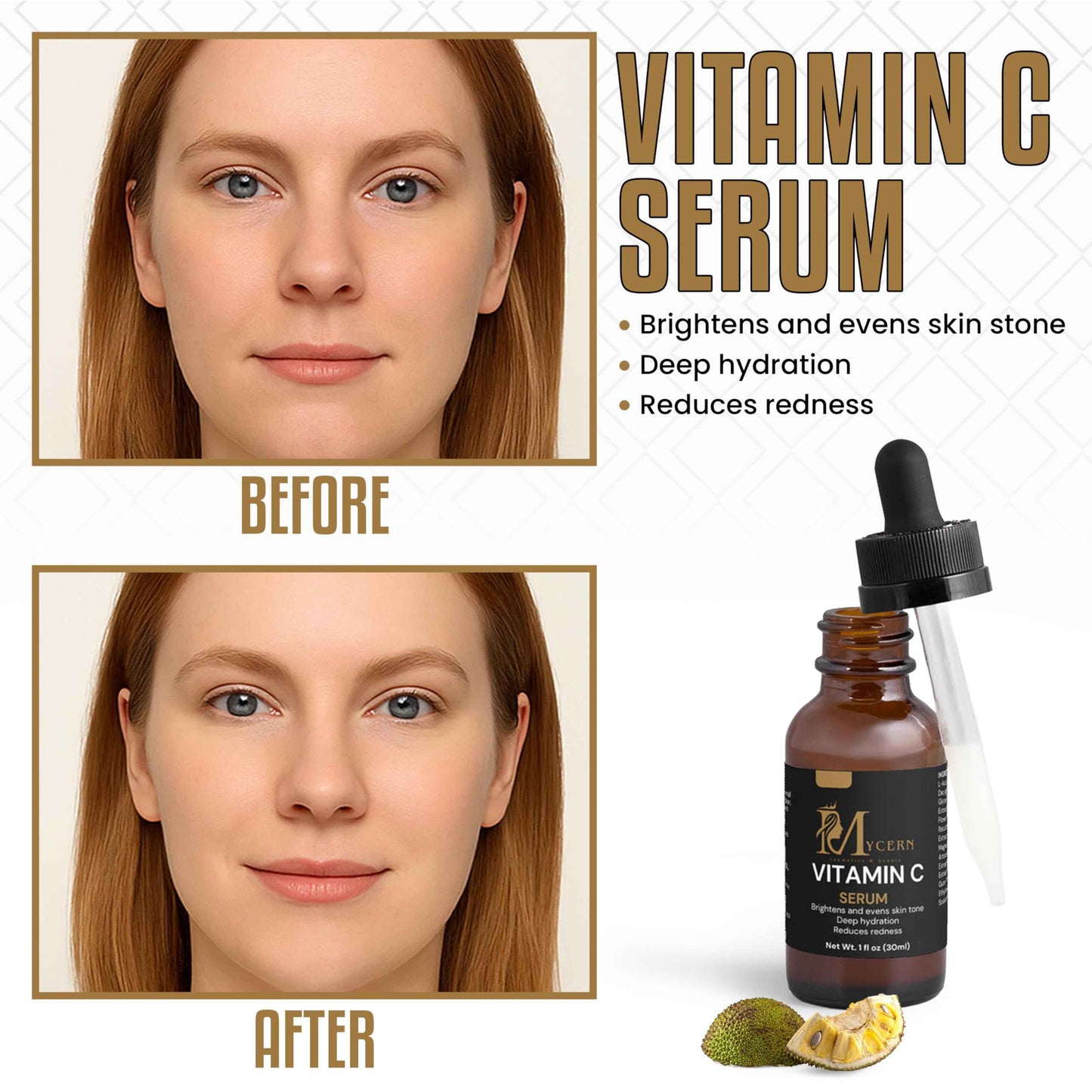 Vitamin C Serum for Face – Brightening & Hydrating Face Serum, Anti-Aging Skin Care with Tranexamic Acid & Botanical Extracts – Suitable for All Skin Types