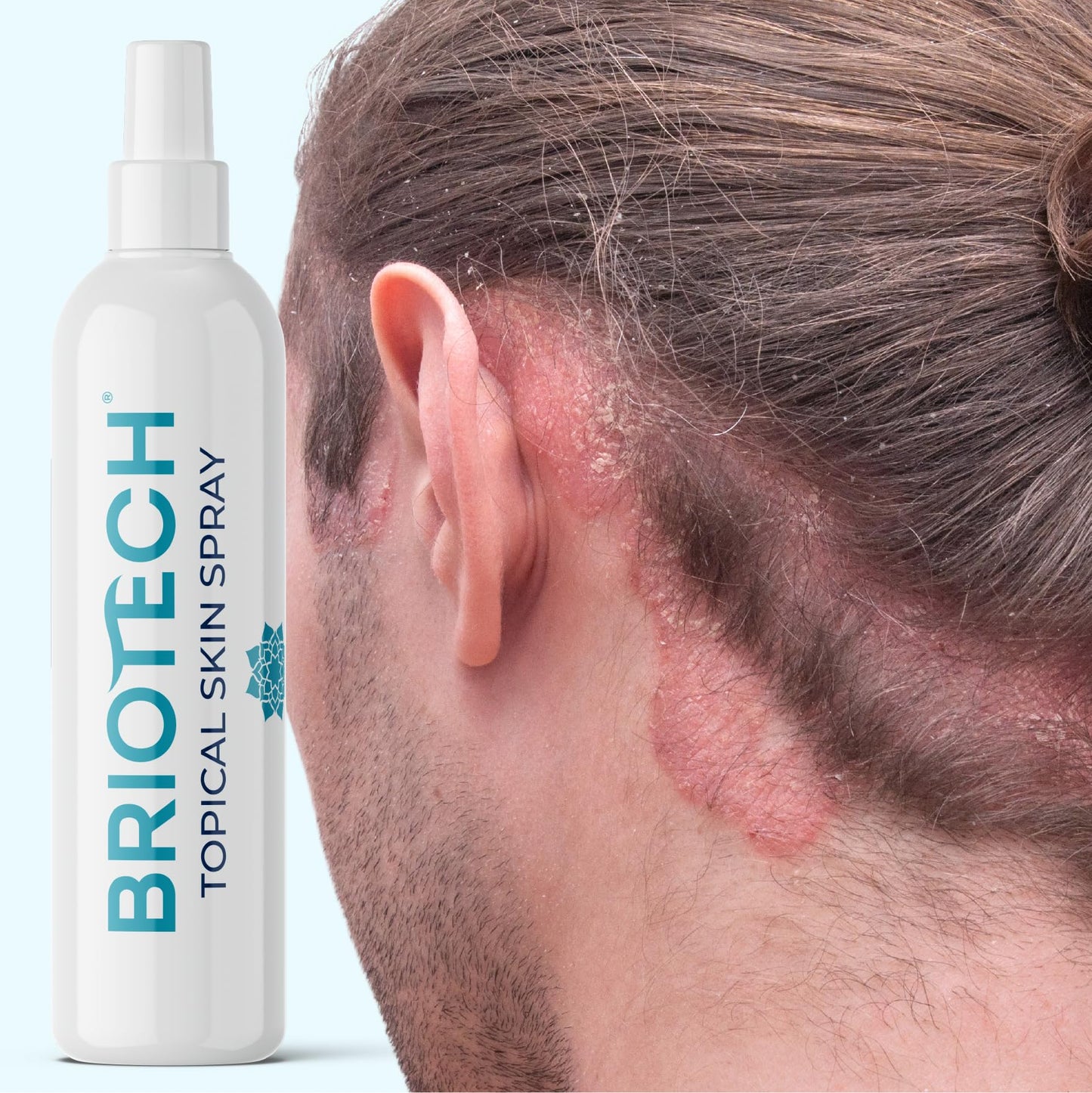 BRIOTECH Topical Skin Spray, Hypochlorous Acid Spray for Body & Face, Eyelid Cleanser, HOCl Facial Mist, Support Against Irritation, Calm Redness, Soothe Scalp, Packaging May Vary, 4 oz ea, 2 ct