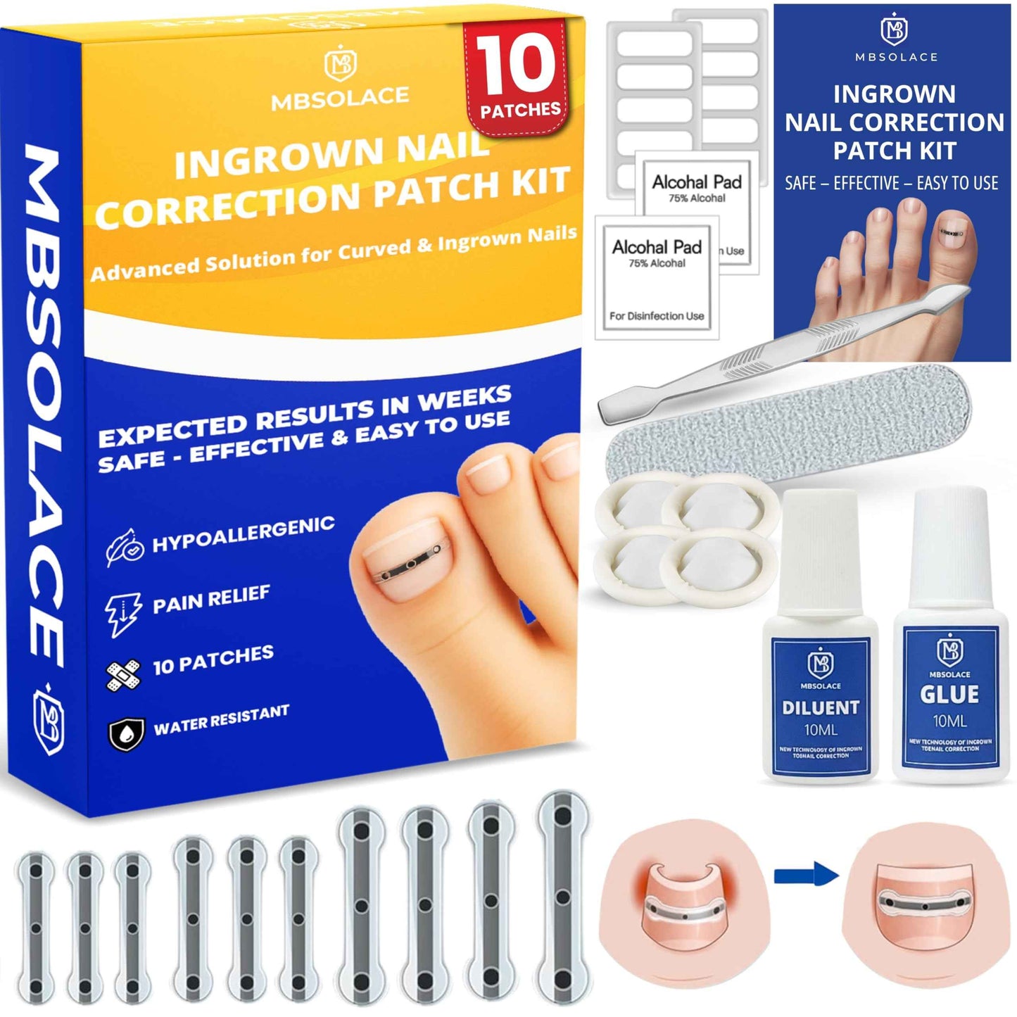 Premium Titanium Alloy Ingrown Toenail Corrector & Treatment Kit – Hypoallergenic Toenail Curve Corrector Strips – Toenail Straightener, Water-Resistant, Quick Relief, Easy Home Use, 10 Pcs in 4 Sizes
