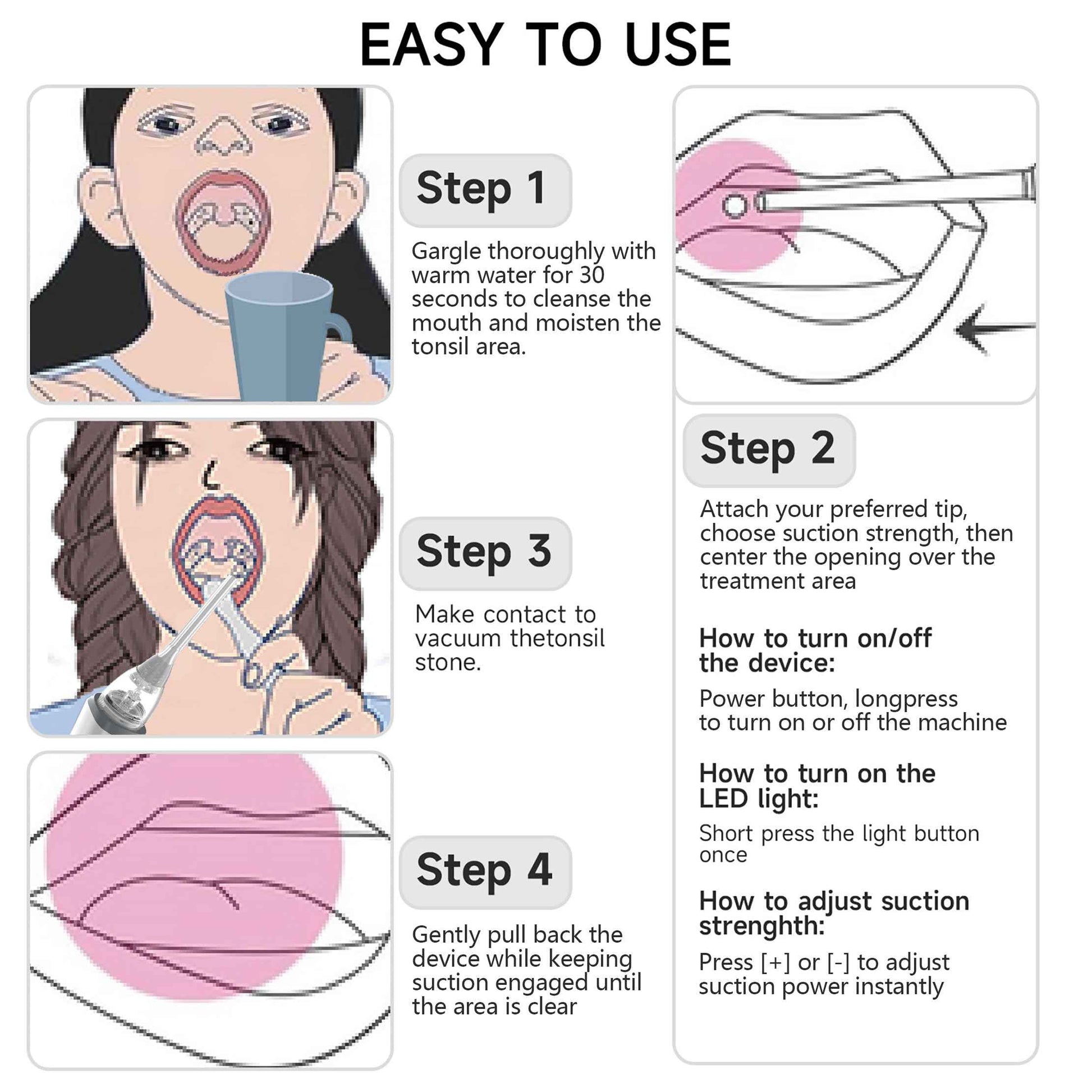 Electric Tonsil Stone Remover Kit - 5 Silicone Tips, 3 Suction Levels, Rapid USB-C Charging, Integrated LED - Gentle & Painless for Home Use, Doctor Recommended