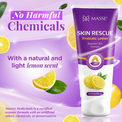 Candida Freedom Massey's Skin Rescue Probiotics Lotion - Daily lotion for Men & Women - Refreshing Lemon Scent - Non-Greasy Moisture for Smooth & Sensitive Skin - 3.4 oz