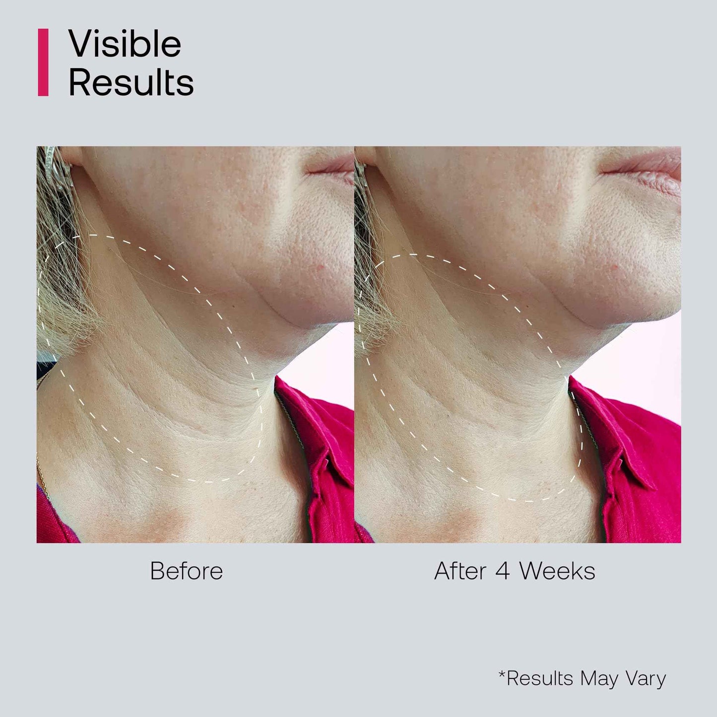 Bestkiss Retinol Neck Firming Cream with Cooling & Massaging Roller Applicator - Hydrates, Lifts, Smoothes Wrinkles, Fine Lines & Tightens Sagging Skin with Niacinamide & Hyaluronic Acid, 1.7oz/50g