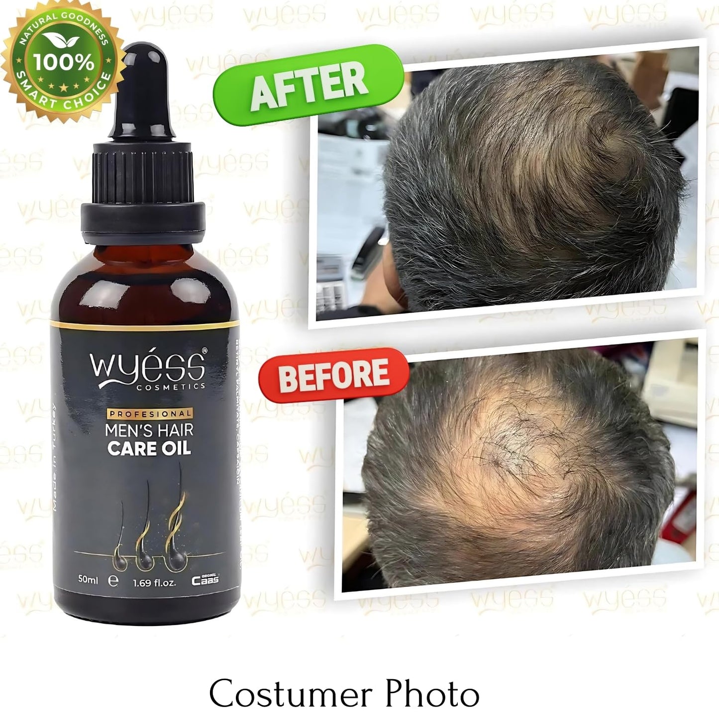 WYESS Natural Argan Oil Serum for Men's Hair Growth, Stimulating and Easy to Use