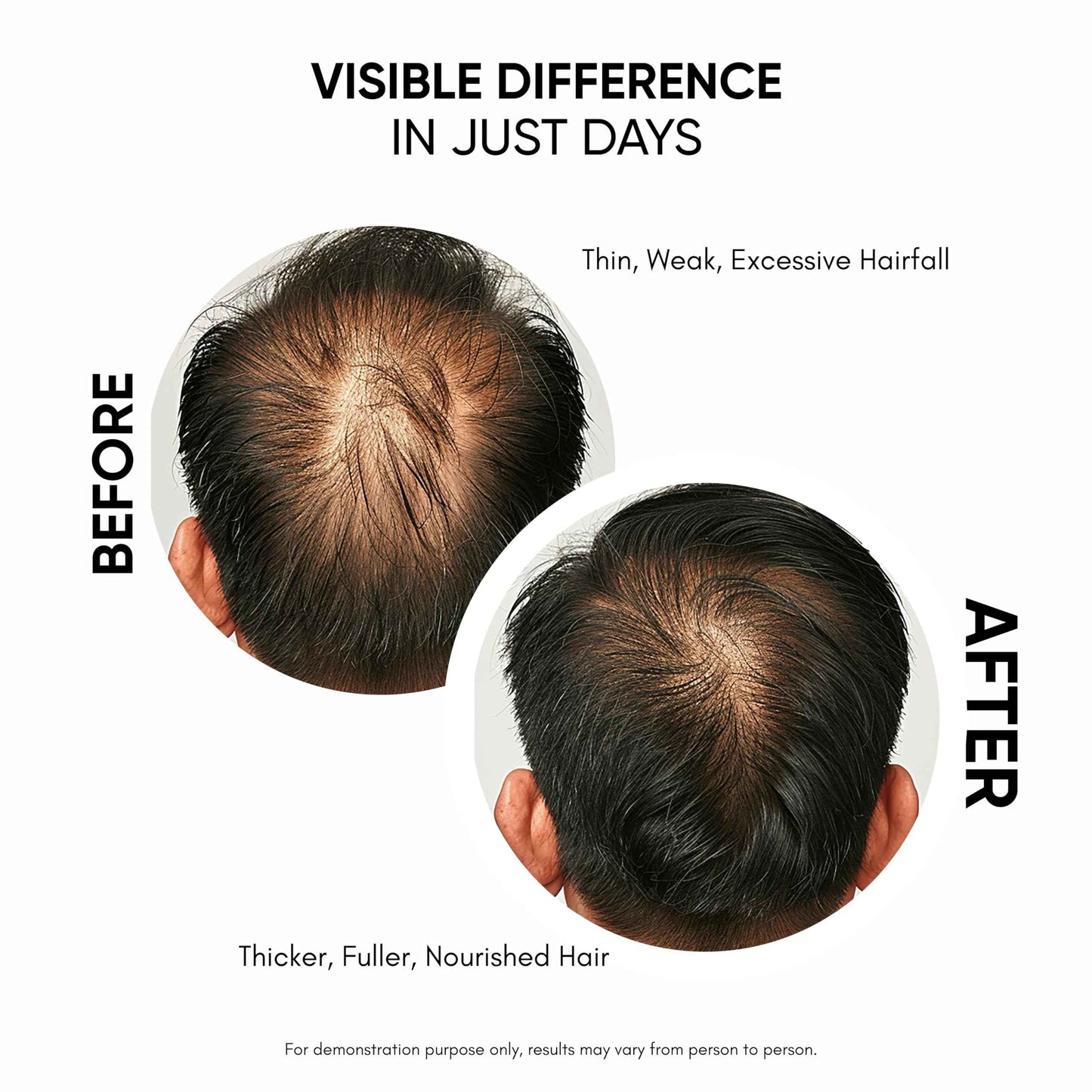 Masofta Hair Growth Serum For Promoting Hair Growth & Controlling Hair Fall With 3% Redensyl, 5% Capixyl, 4% Anagain, 3% Procapil & Rosemary & Biotin, For Both Men & Women, 50 ml (Pack of 1) White