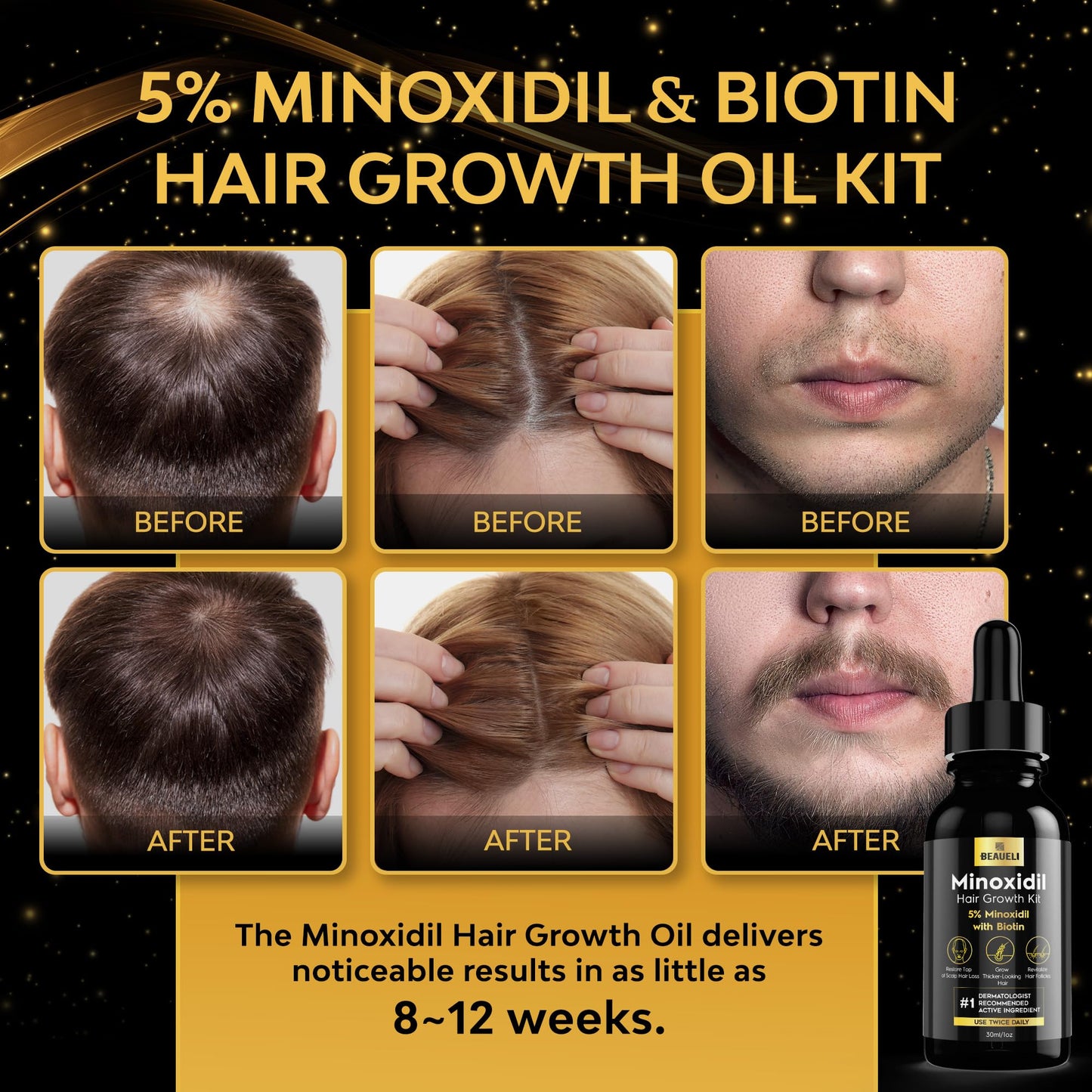 5% Minoxidil for Men, Minoxidil for Women Hair Growth Serum, Minoxidil 5 Percent, Hair Growth for Women and Men with Biotin, Hair Loss Treatments, Hair Regrowth Treatment for Thicker Fuller Hair 30ml