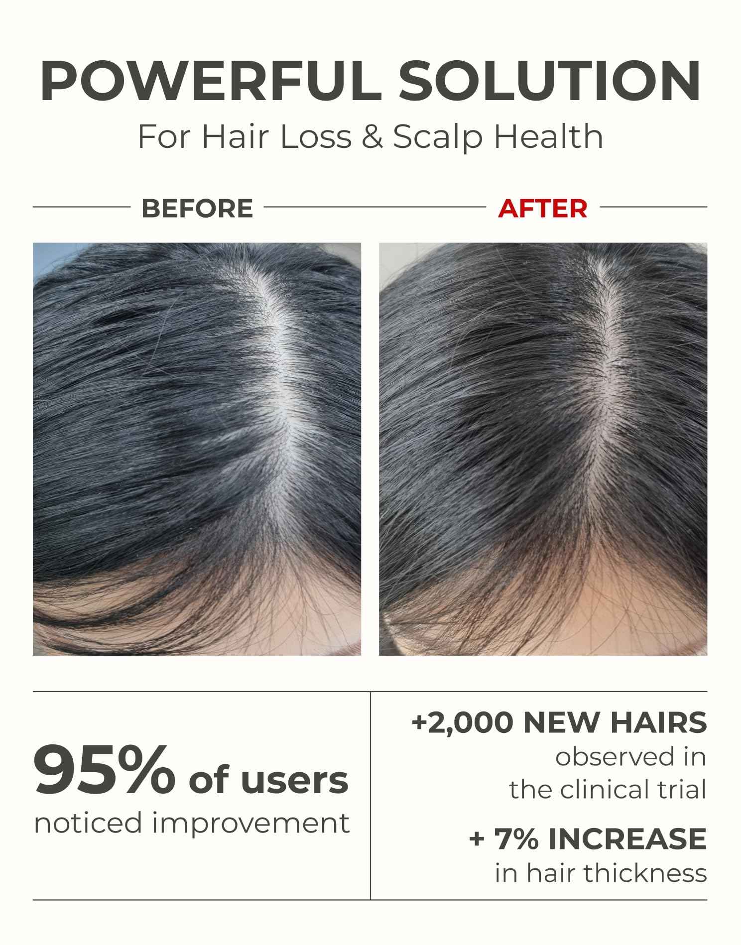 Motifull Hair Boosting Hair Thickening Shampoo for Thinning Hair with Biotin & Caffeine | Hair Growth Shampoo for Stronger Root & Volume (16.9 fl oz)