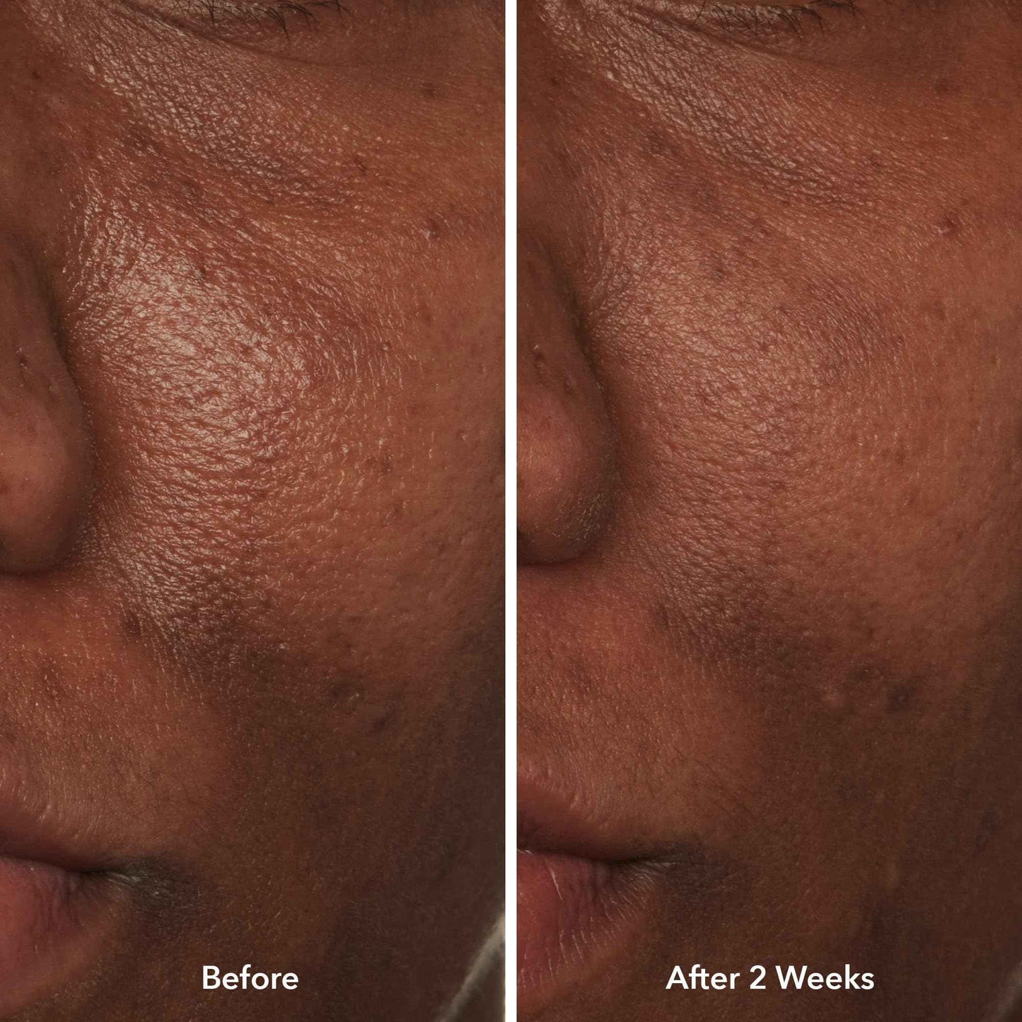 Beekman 1802 Potato Peel - 1.69 fl oz - Fragrance Free - Rapid Resurfacing Milk Facial - At-Home Peel - Visibly Reduces Appearance of Fine Lines & Dark Spots - Good for Sensitive Skin - Cruelty Free