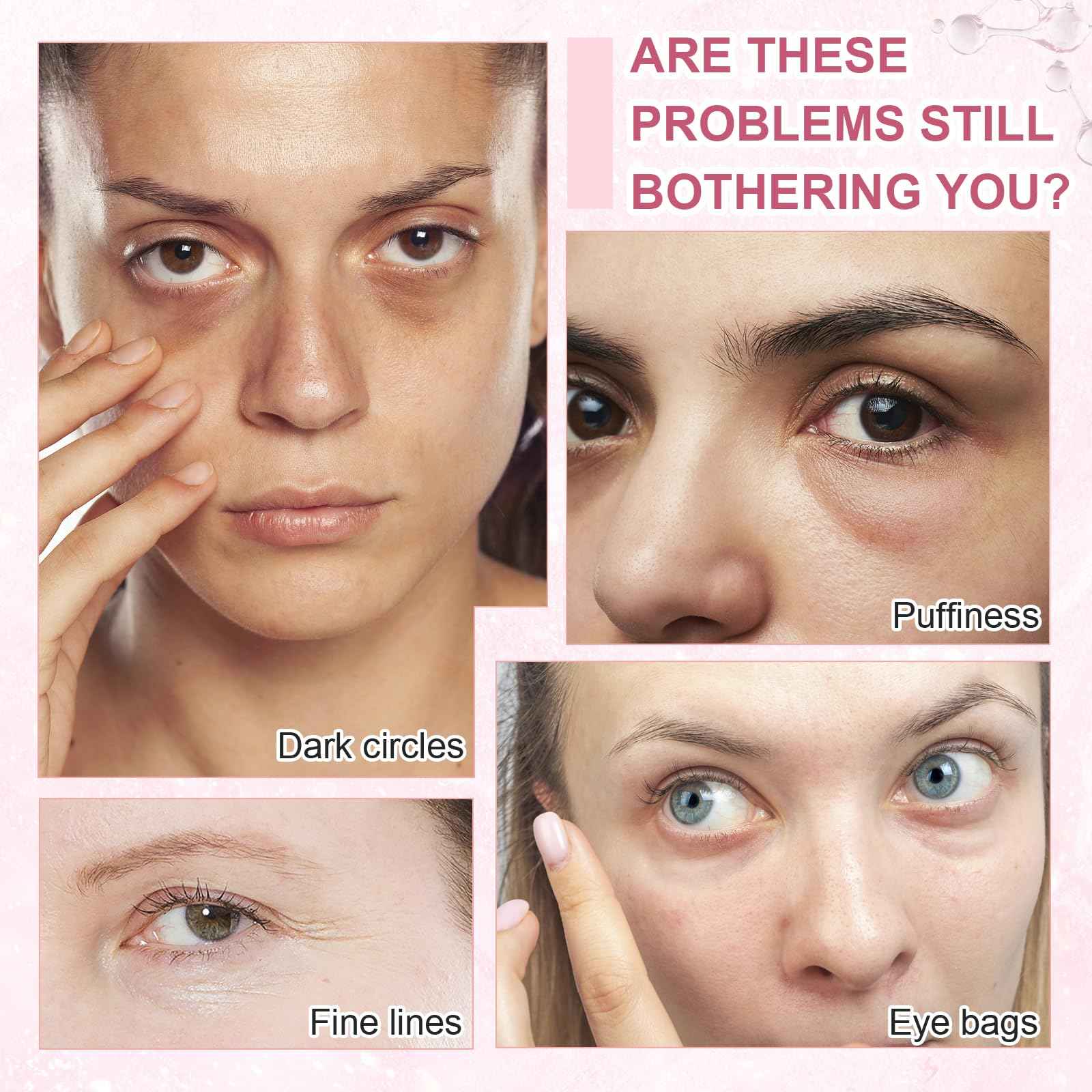 OMPLEN 5% Caffeine Eye Serum Treatment,Hyaluronic Acid & Niacinamide, Under Eye Cream for Dark Circles, Anti Aging 360° Massage Rollerball - Reduce Puffiness, Wrinkles & Fine Lines, 0.5 fl. oz