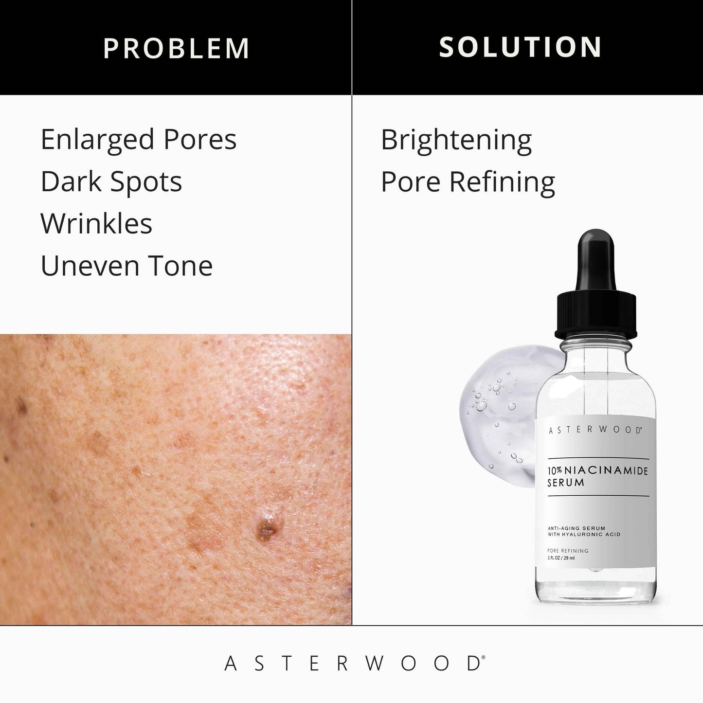 Asterwood Matrixyl 3000 + Argireline Serum 1 oz + 10% Niacinamide Serum 1 oz
