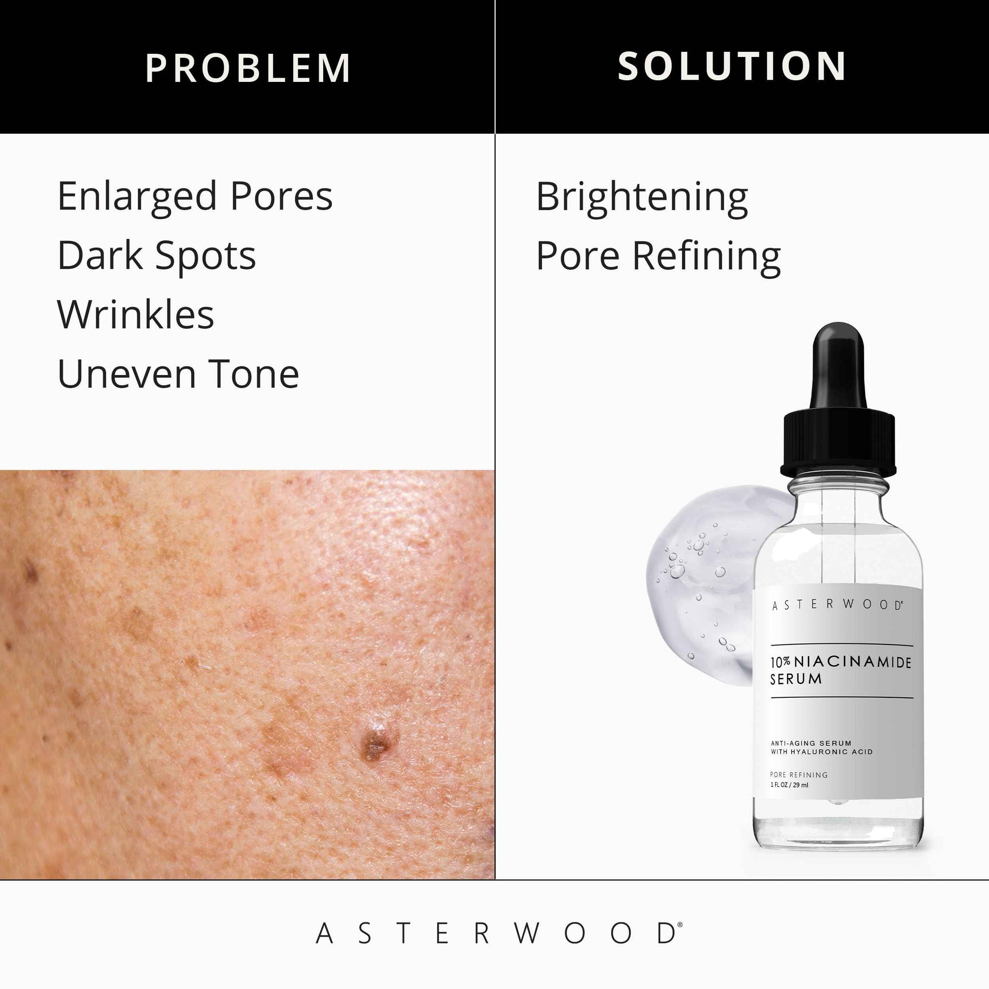 Asterwood Matrixyl 3000 + Argireline Serum 1 oz + 10% Niacinamide Serum 1 oz