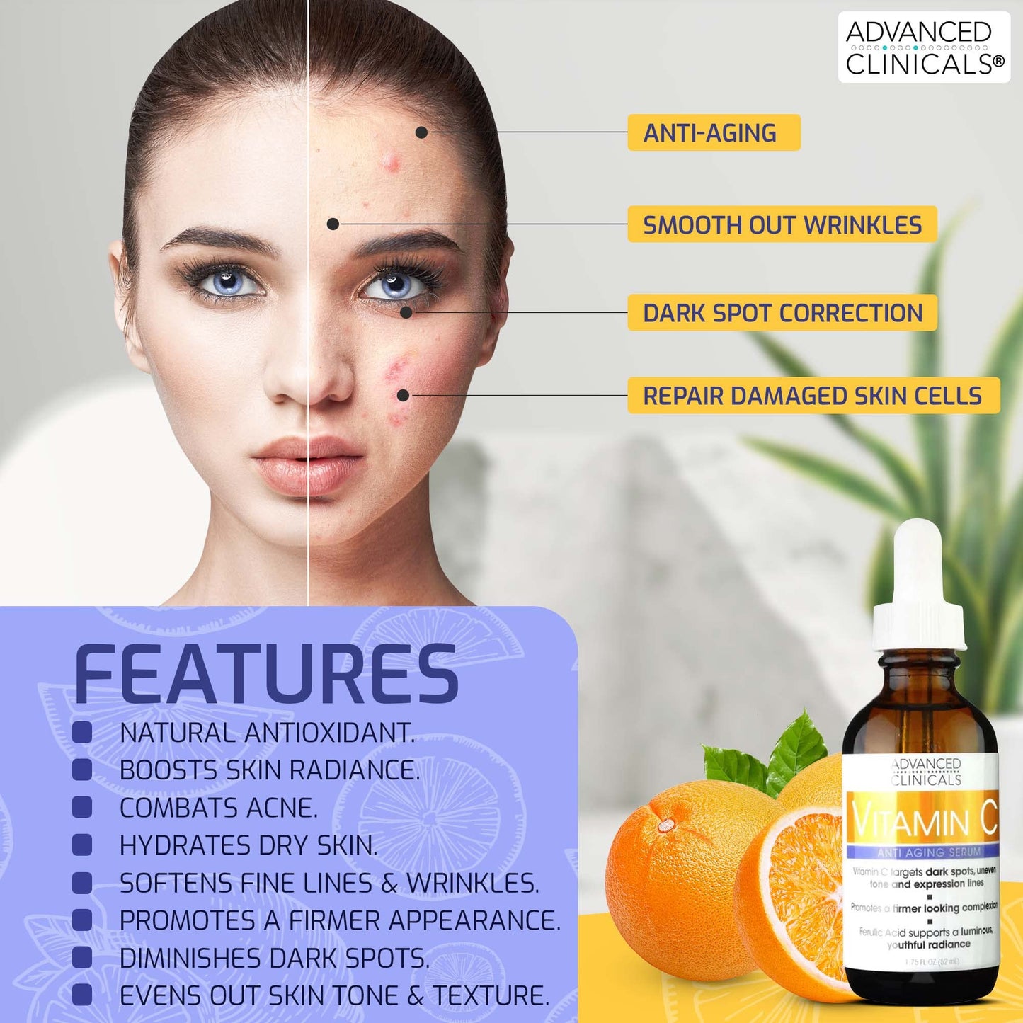 Advanced Clinicals Retinol Serum For Face + Hyaluronic Acid Serum + Vitamin C Serum Skincare Set | Face Serum For Women | Anti Aging Serums For Brightening, Firming, & Hydrating | 1.75 Fl Oz, 3pc Set