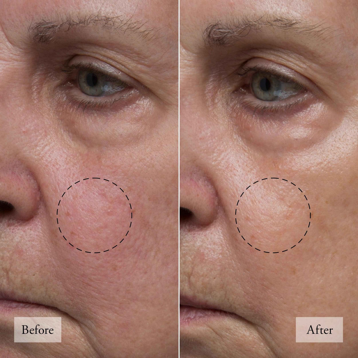 philosophy hope in a jar skincare essentials mini set