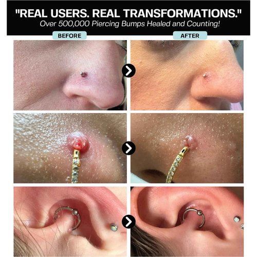 BASE LABORATORIES Piercing Aftercare Hypochlorous Acid Spray PRO - 8 OZ | Saline Solution Piercing Aftercare - Saline Spray for Ear Piercings, Bumps & Keloids | Ear, Nose, Belly - 2PK