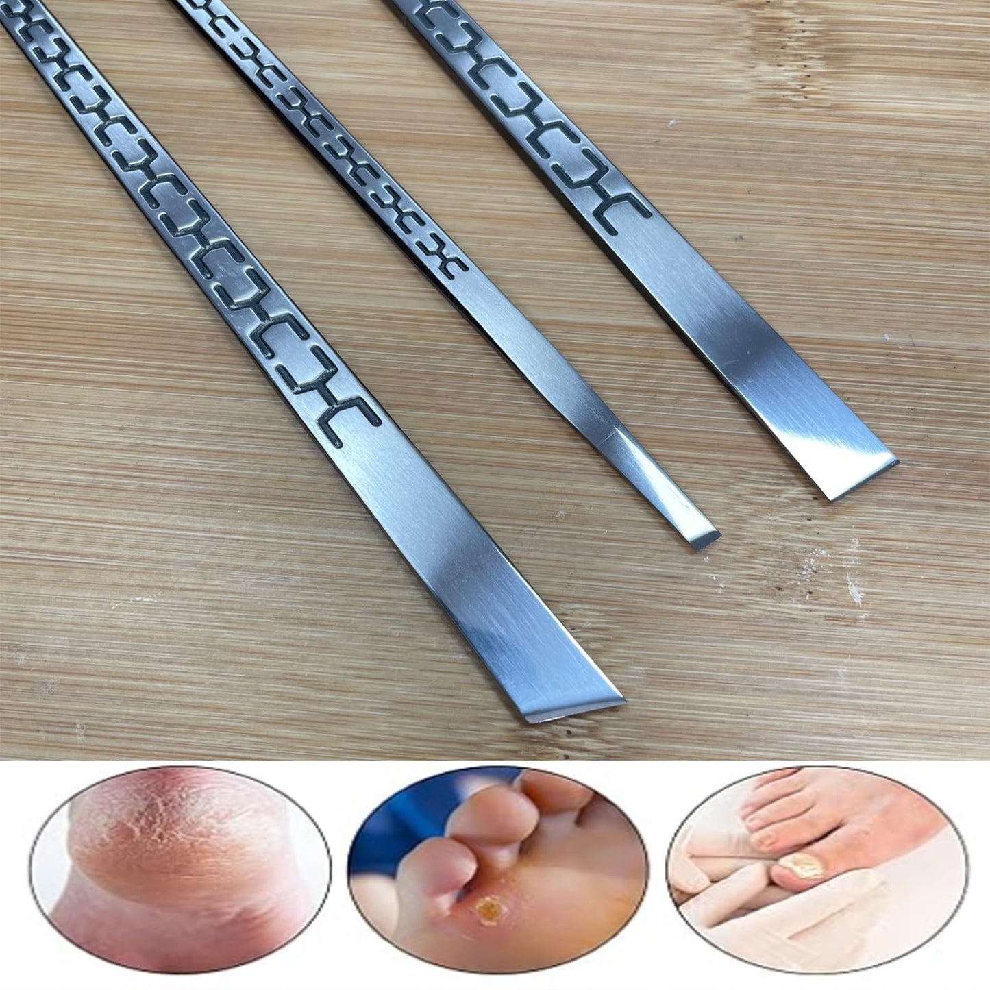 Stainless steel ingrown toenail pedicure knife set,professional foot skin scraper repair sharp blade kit for nail corn callus paronychia treatment. (1)