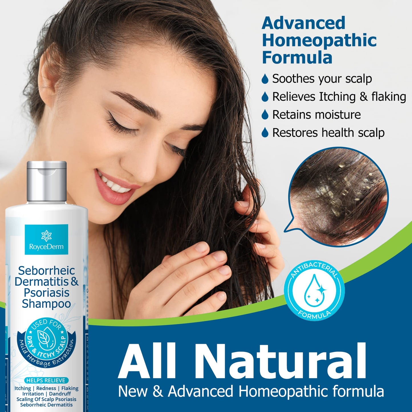 Roycederm Psoriasis Shampoo, Seborrheic Dermatitis Shampoo, Folliculitis Shampoo, Dandruff Shampoo, Scalp Psoriasis & Seborrheic Dermatitis Treatment, Dry Itchy Scalp Treatment