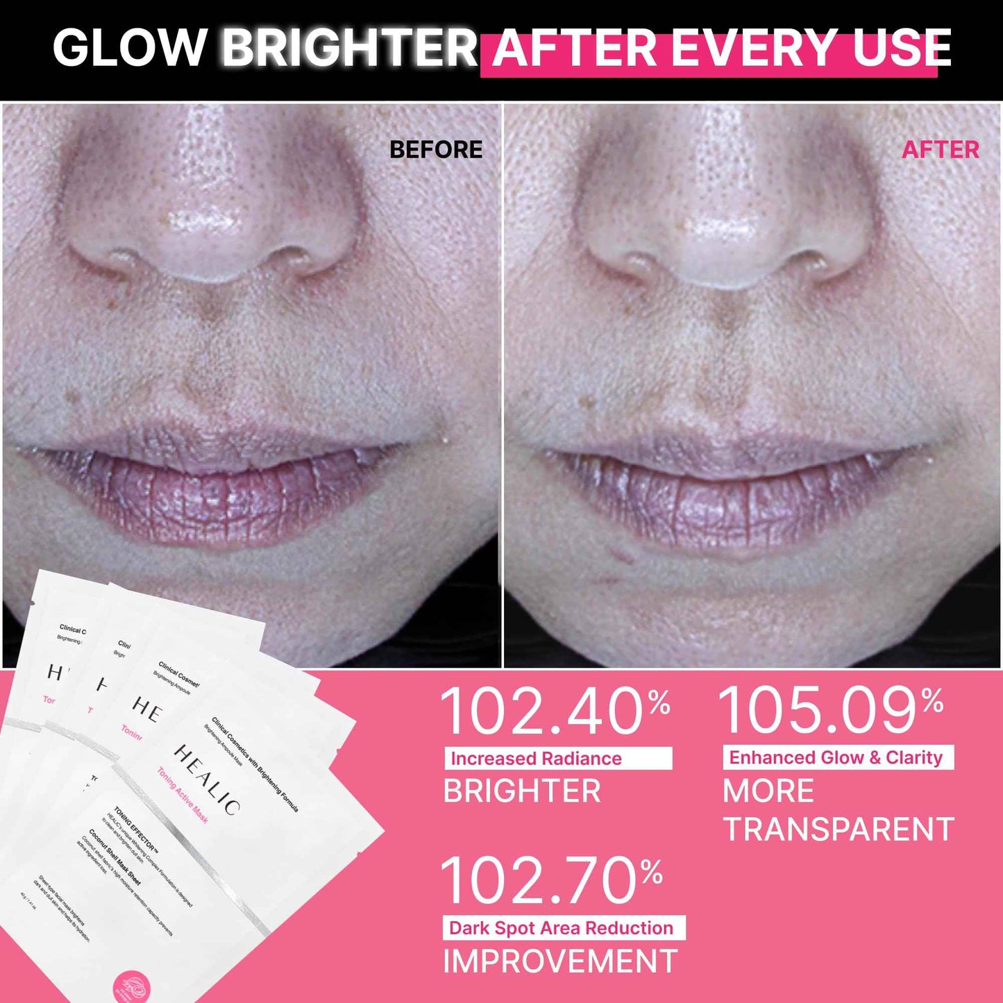 HEALIC Toning Active Mask – Brightening, Hydrating&Soothing Face Mask with Tranexamic Acid & Hyaluronic Acid, Sheet Mask with Coconut Fiber, Gentle for Sensitive Skin, Korean Skin Care, Vegan, 5EA