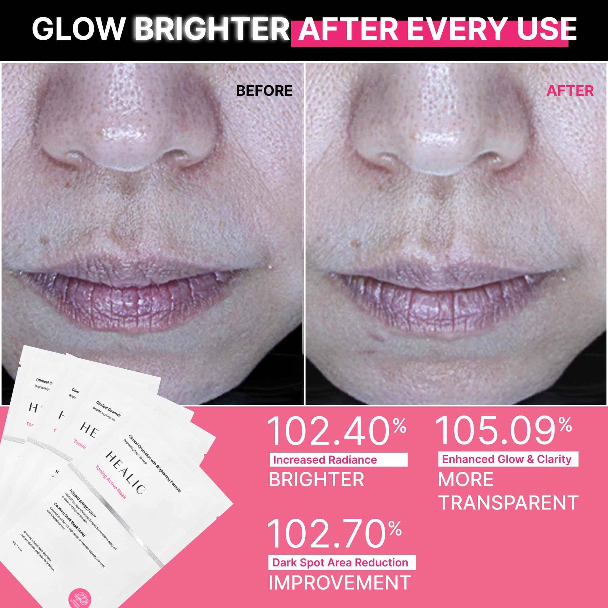 HEALIC Toning Active Mask – Brightening, Hydrating&Soothing Face Mask with Tranexamic Acid & Hyaluronic Acid, Sheet Mask with Coconut Fiber, Gentle for Sensitive Skin, Korean Skin Care, Vegan, 5EA