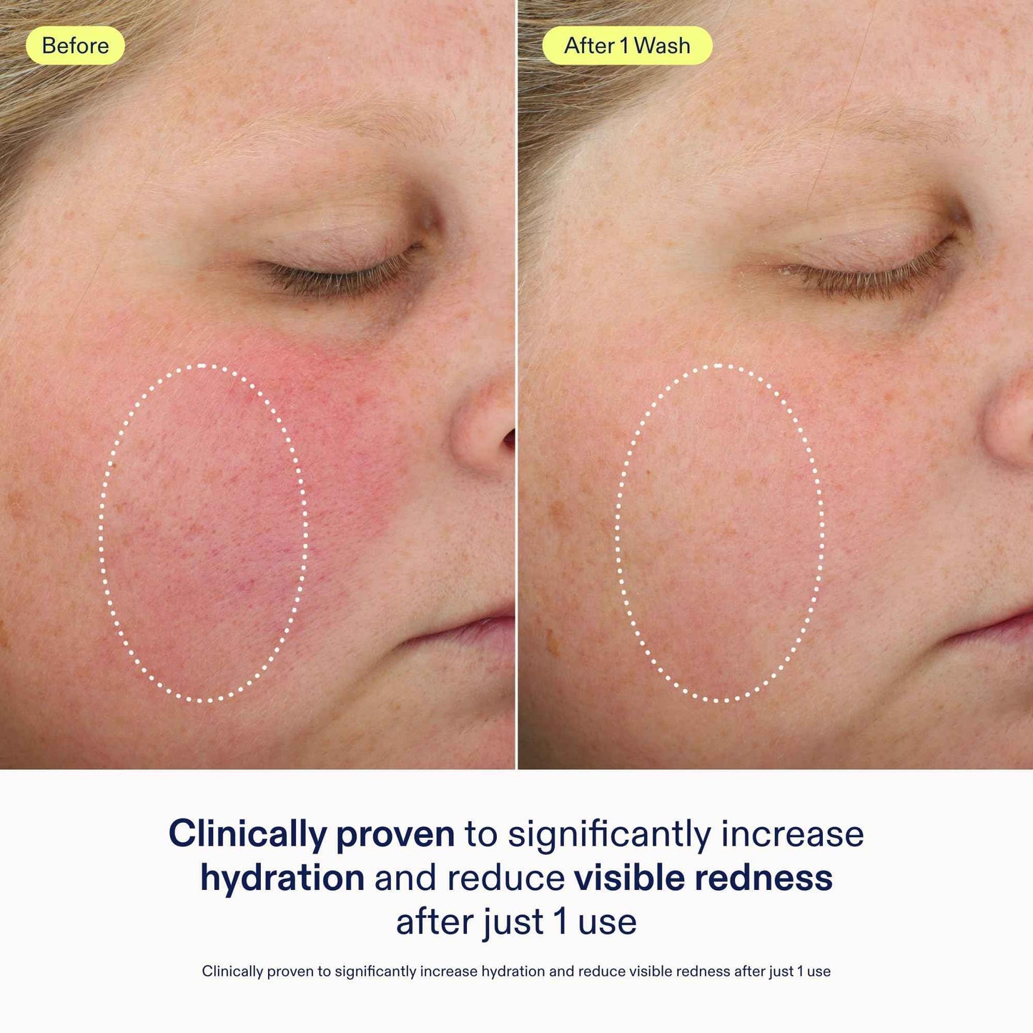 Skinfix Foaming Oil Cleanser for Face - 6 oz - Rich Gel-to-Foam Formula to Hydrate & Soothe Dry, Sensitive Skin - Fragrance Free, Vegan, Cruelty Free