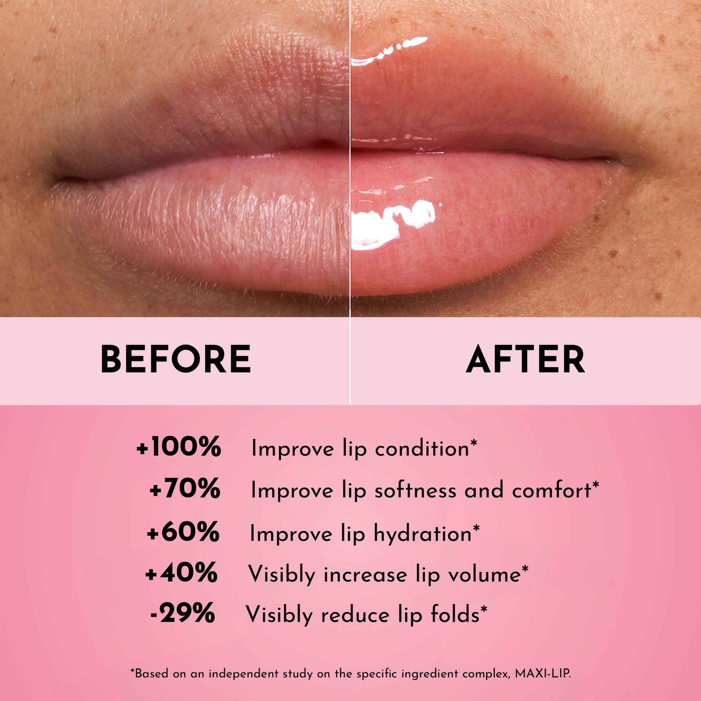 Lawless Women's Forget The Filler Lip Plumper Line Gloss - Queen Size, Cherry Vanilla, Red, 0.19 Fl Oz (Pack of 1)