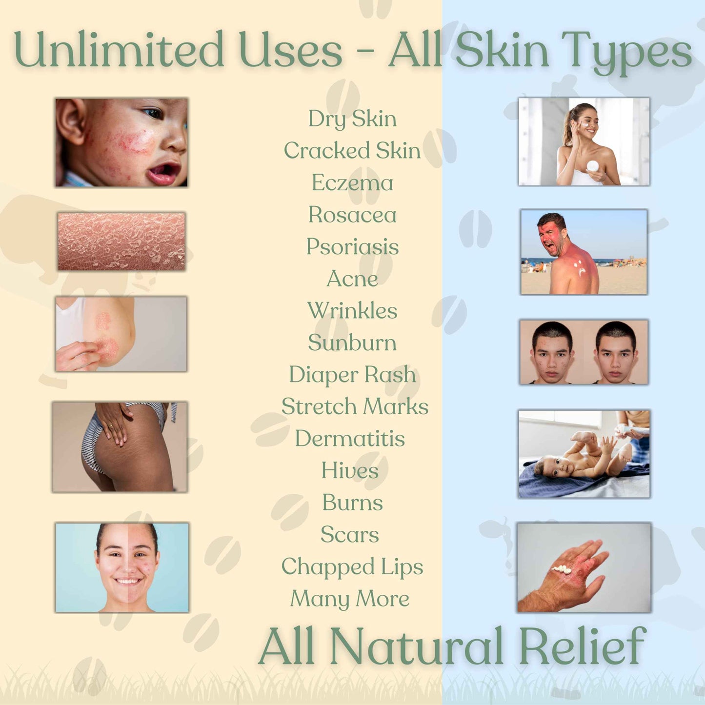 Beef Tallow for Skin | NAKED TALLOW BALM | 1 Ingredient - 100% Grass Fed Beef Tallow | Beef Tallow for Body & Face | Whipped & UNSCENTED for Sensititve Dry Skin, Babies, Eczema, Psoriasis, Rosacea (4oz)