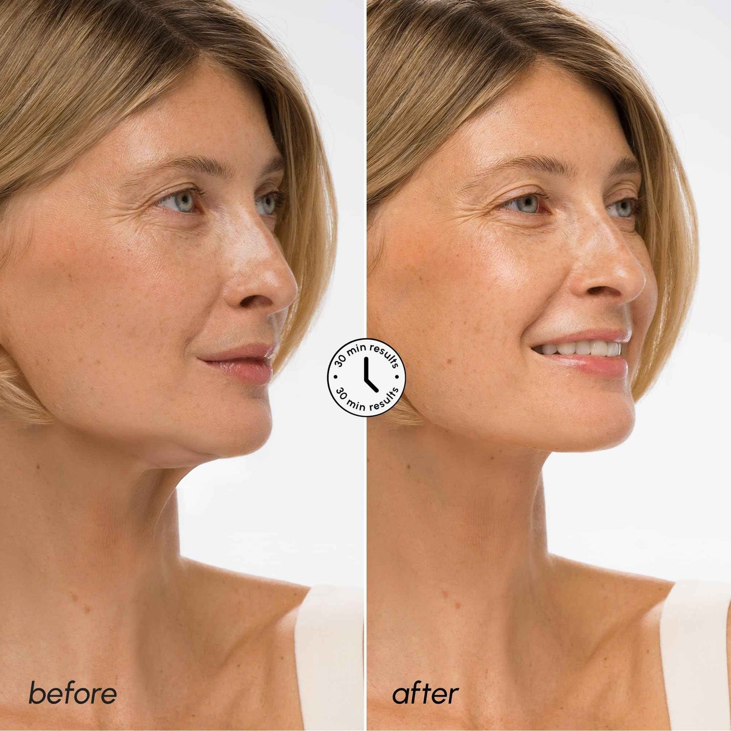 MAREE V Line Lifting Mask with Hyaluronic Acid – Deep Collagen Face Mask for Women – Jawline Shaper Facial Masks with Retinol – Tightening & Firming Neck Lift Tape – Double Chin Strap for Face Lift