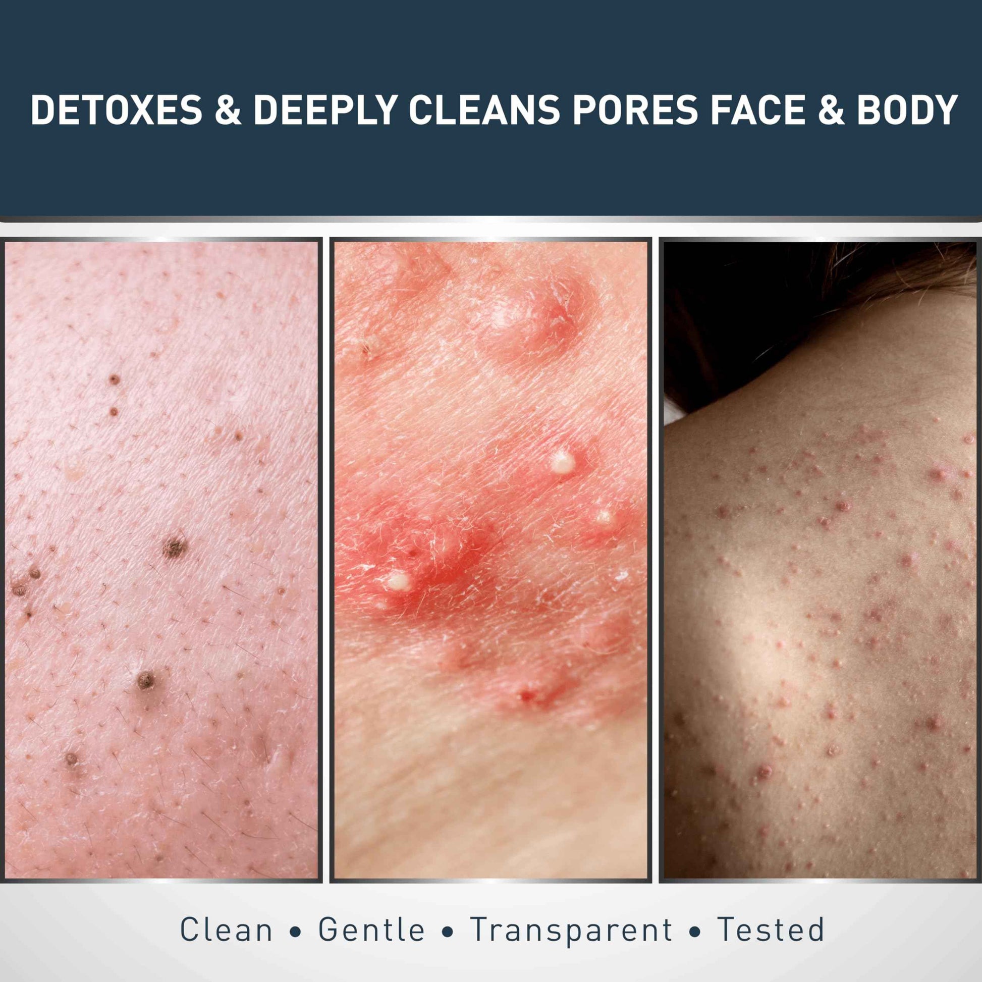 Jericho Dead Sea Mud Soap Bar, Natural Face & Body Detox with Exfoliating Dead Sea Minerals & Soothing Witch Hazel. 4.4 Oz /125g (Pack of 9)