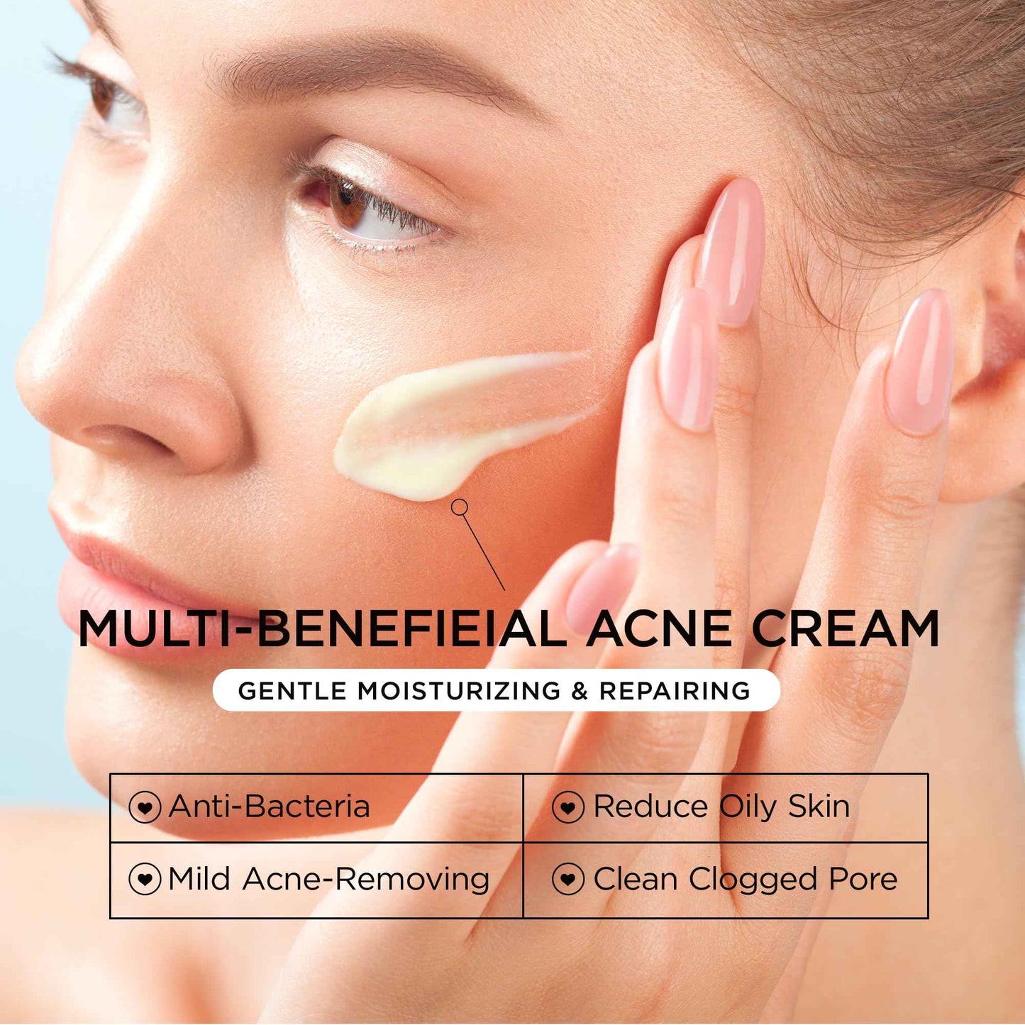 BellamiLuxx Cystic Acne Treatment for Face: Hormonal Acne Treatment Cream for Teens & Adults - Salicylic Acid & Tea Tree Oil Pimple Spot Remover - Anti-Acne Moisturizer Reduces Redness, Blemishes