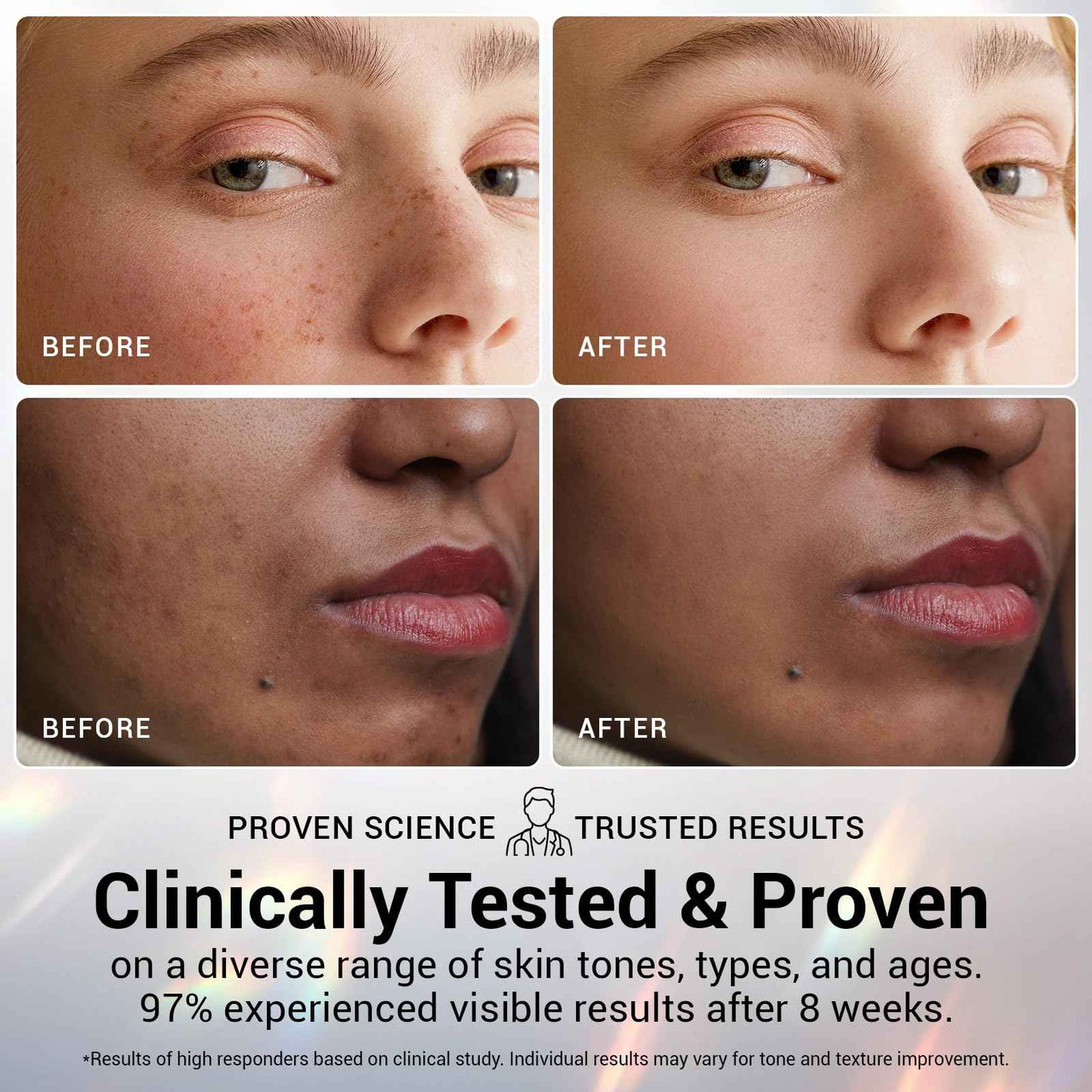 Ultra Hydrating Set: 5% Hyaluronic Acid + Emergency Repair Oil Suspension Serum for Sensitive, Dry & Damaged Skin | Instant Lift & Firming, Soothing for Face 90ml (Hyaluronic+Oil Serum 2pcs)