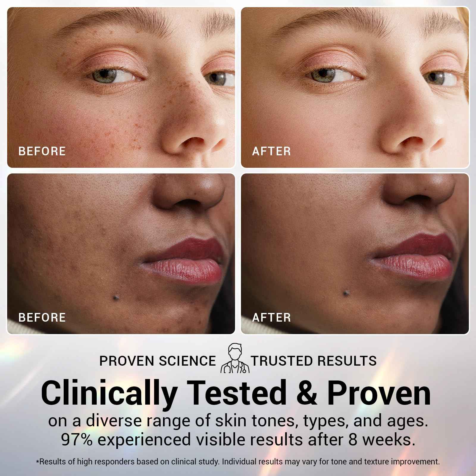 Ultra Hydrating Set: 5% Hyaluronic Acid + Emergency Repair Oil Suspension Serum for Sensitive, Dry & Damaged Skin | Instant Lift & Firming, Soothing for Face 90ml (Hyaluronic+Oil Serum 2pcs)