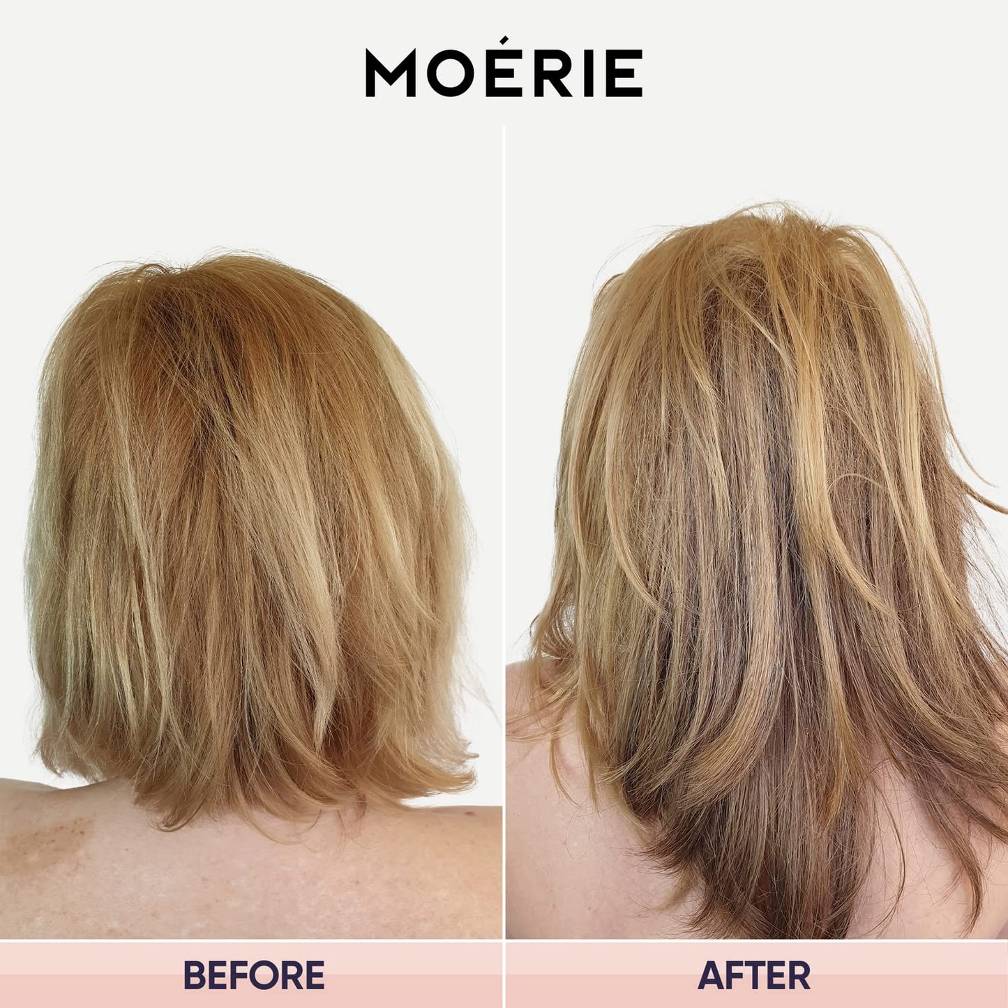 Moerie Ultimate Hair Growth Shampoo – For Longer, Thicker, Fuller Hair - Vegan Friendly Volumizing Hair Products – Paraben & Silicone Free – All Hair Types – Reverse Hair Loss – 8.45 fl oz (250ml)