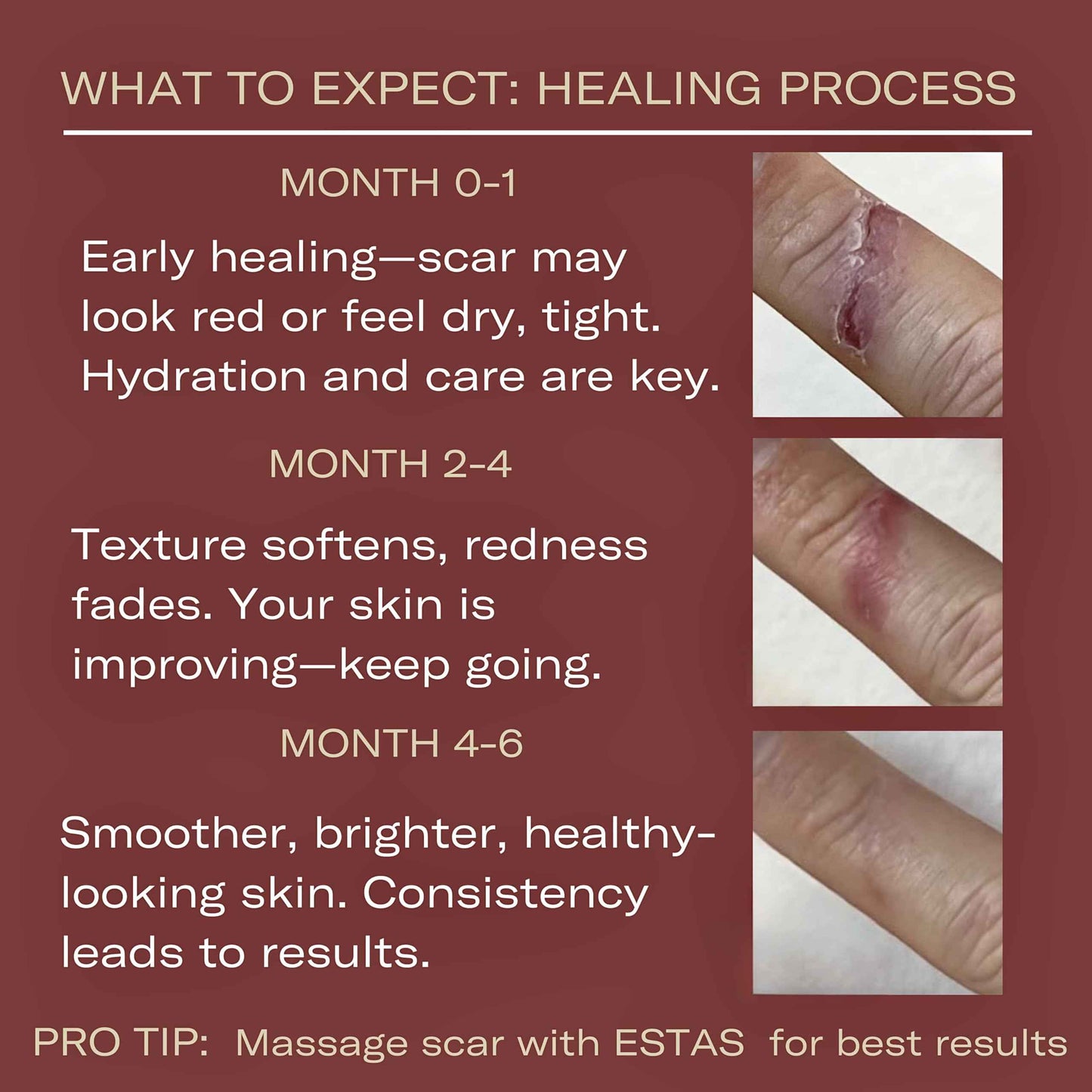 ESTAS Beauty Scar Cream On The Go -Daily Vitamin E & C with Silicone, For Old & New Scars on Face & Body, Ideal For Surgical, Burn, C-Section & Acne Scars, Vegan + Cruelty Free, (0.17oz pack of 3)