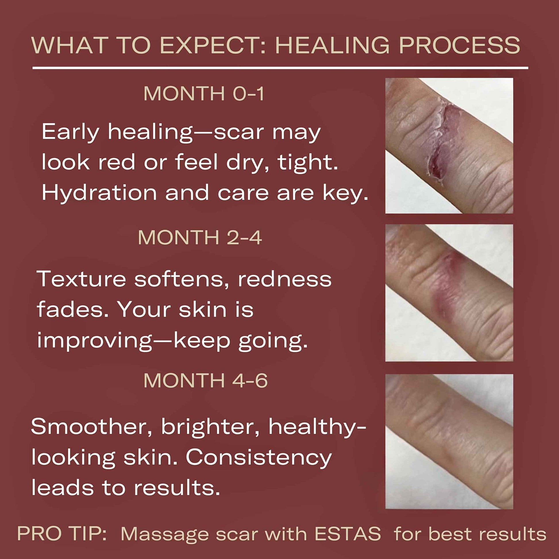 ESTAS Beauty Scar Cream On The Go -Daily Vitamin E & C with Silicone, For Old & New Scars on Face & Body, Ideal For Surgical, Burn, C-Section & Acne Scars, Vegan + Cruelty Free, (0.17oz pack of 3)