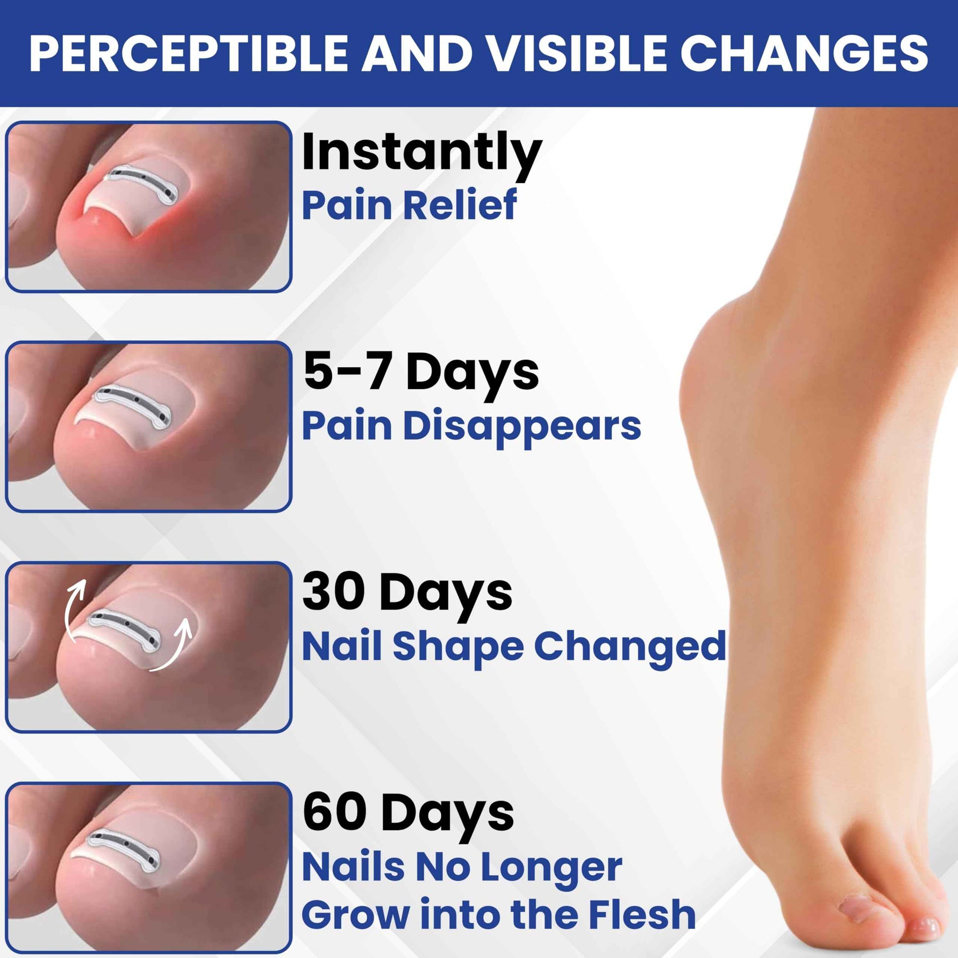 Premium Titanium Alloy Ingrown Toenail Corrector & Treatment Kit – Hypoallergenic Toenail Curve Corrector Strips – Toenail Straightener, Water-Resistant, Quick Relief, Easy Home Use, 10 Pcs in 4 Sizes