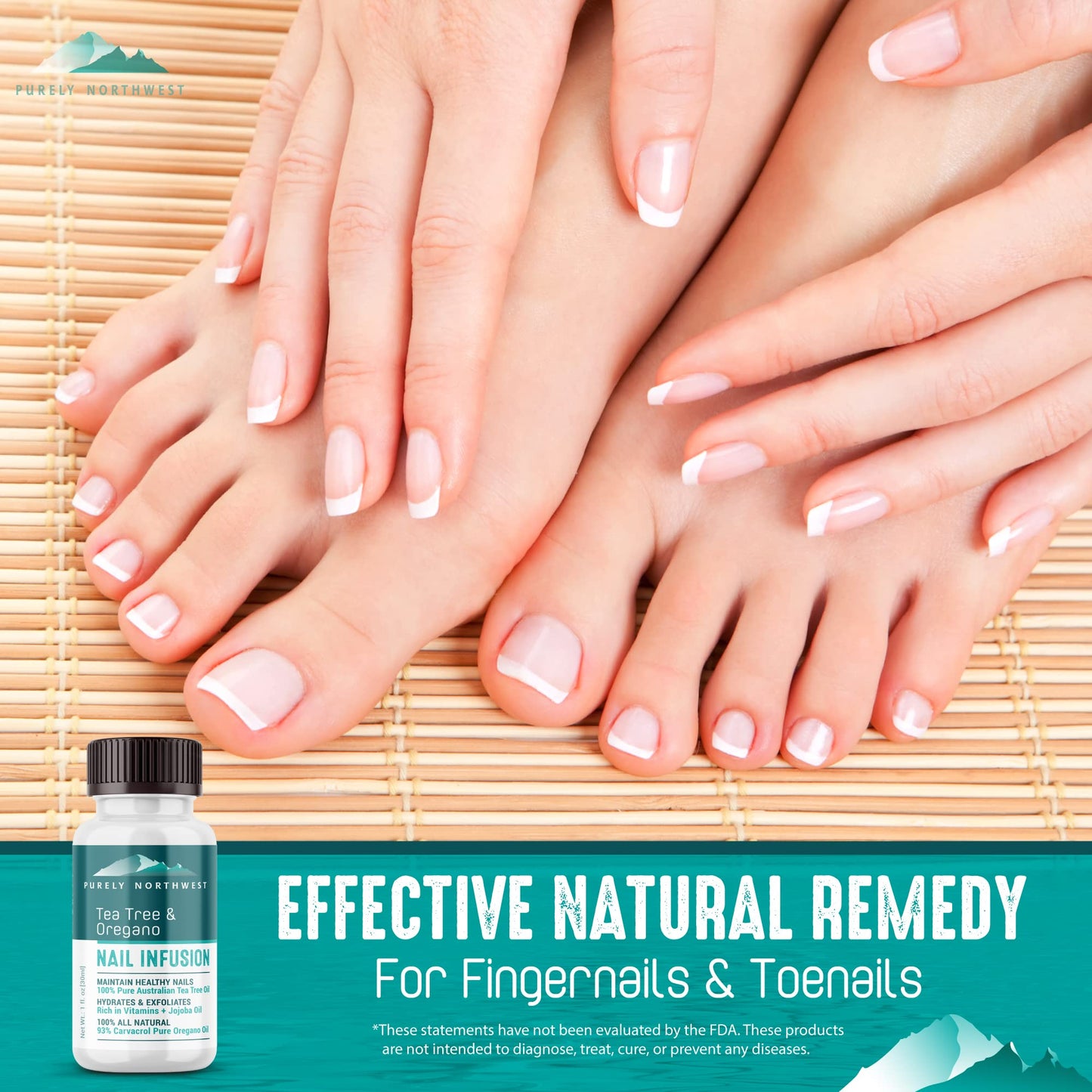 Extra Strength-100% All Natural Fungus Nail Solution for Toenail & Fingernails: Renew Thick, Broken & Discolored Nails Made by Purely Northwest -1fl.oz