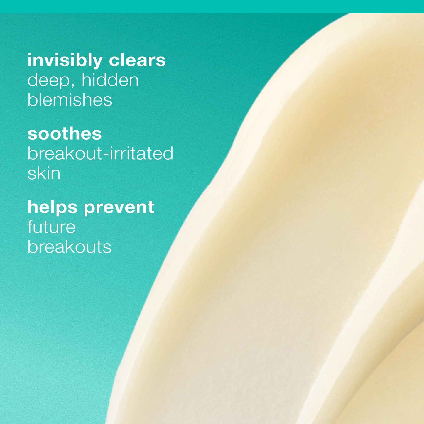 Dermalogica Deep Acne Liquid Patch, Sulfur Acne Treatment with Niacinamide, Invisible Spot Treatment for Blemish-Prone Skin – 0.5 fl oz