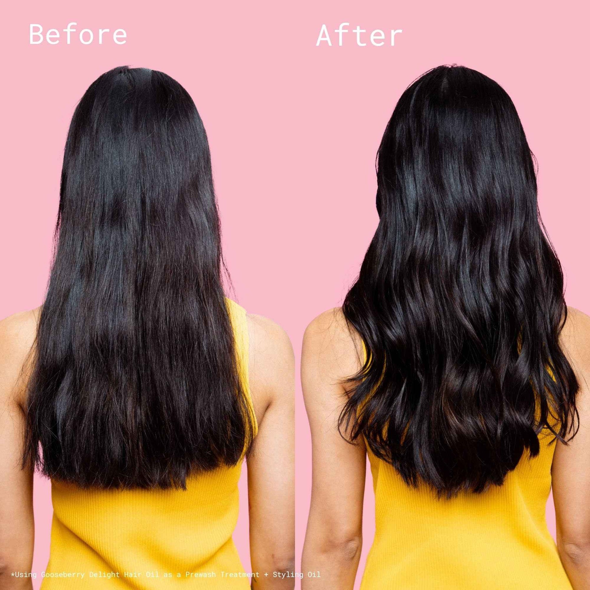 Squigs Hair Growth Oil for Dry & Damaged Hair – with Amla, Castor & Coconut Oil Blend for Frizz Control, Hydration & Scalp Treatment – Pre-Wash & Styling Treatment – 130ml