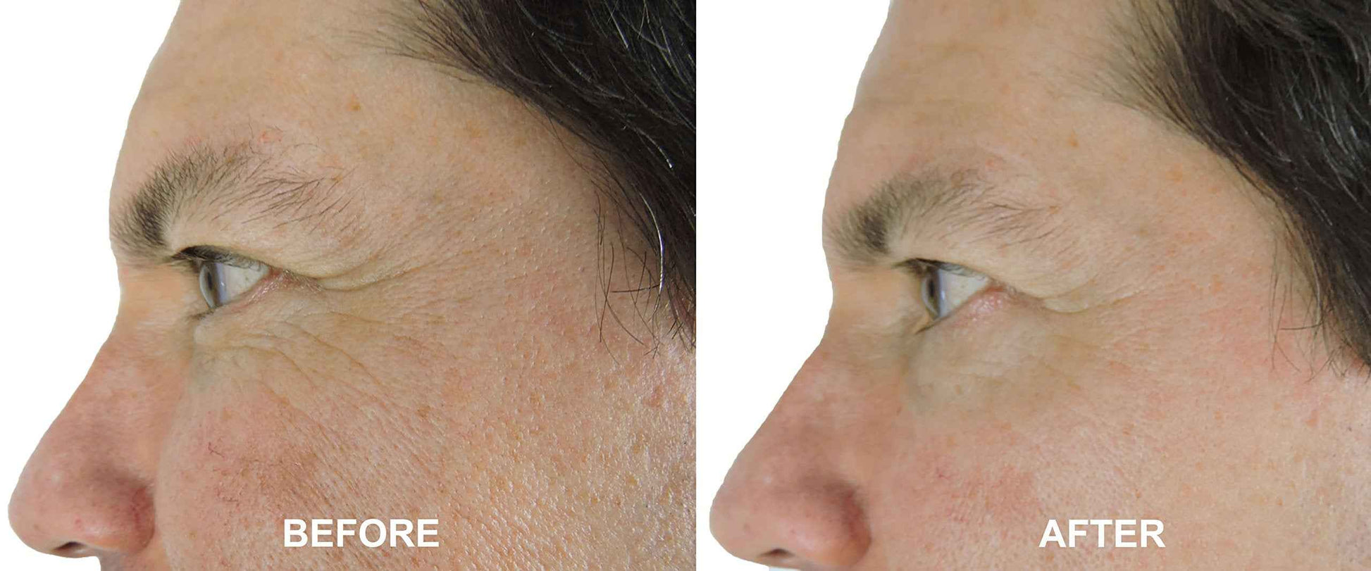 DNA Code®-No Needle Alternative-Argireline Copper Peptide Wrinkle Reduce Serum Booster w/Snap-8, Matrixyl 3000