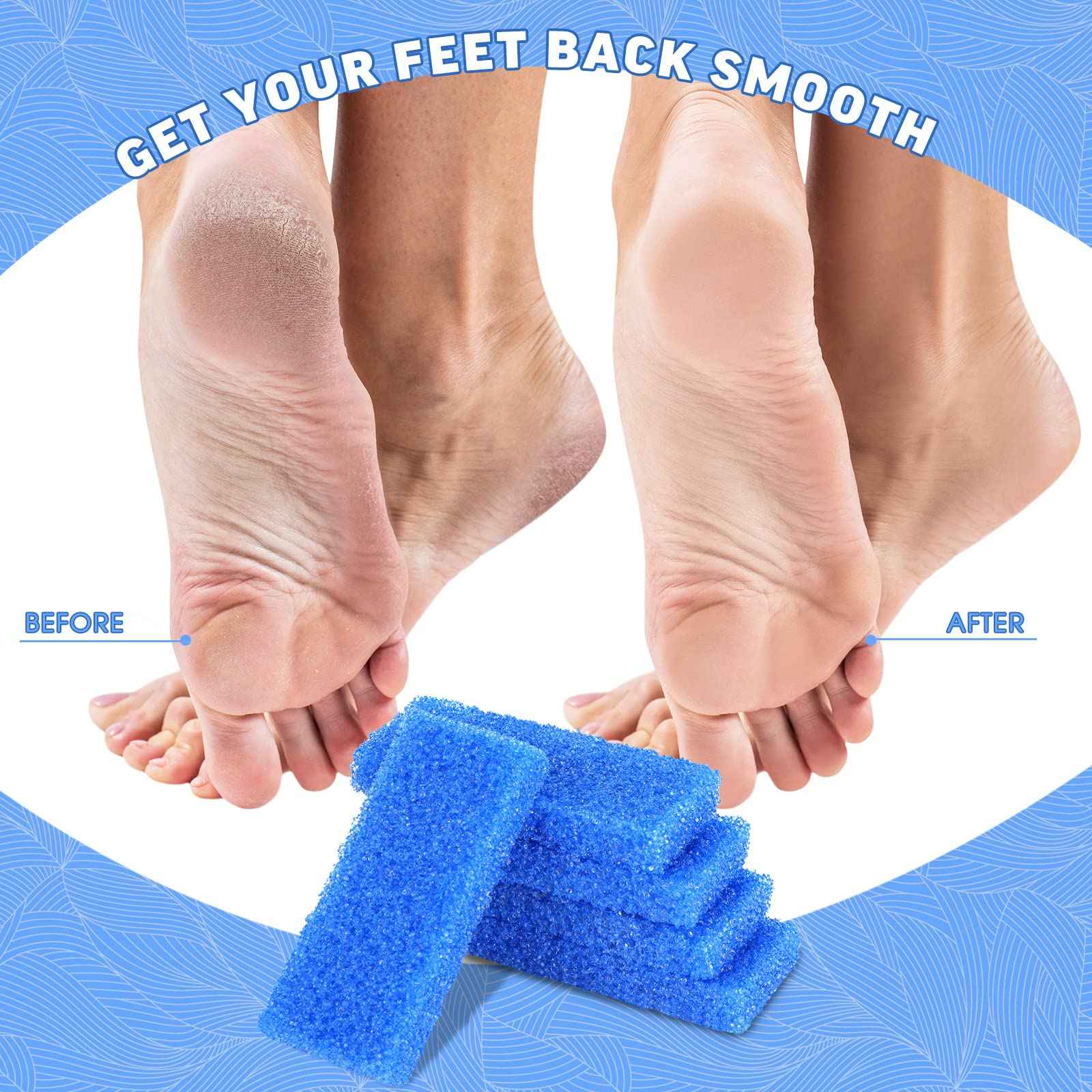 Therwen 400 Pcs Disposable Pumice Stone for Feet Blue Foot Scrubber Dead Skin Callus Remover for Salon Spa Home
