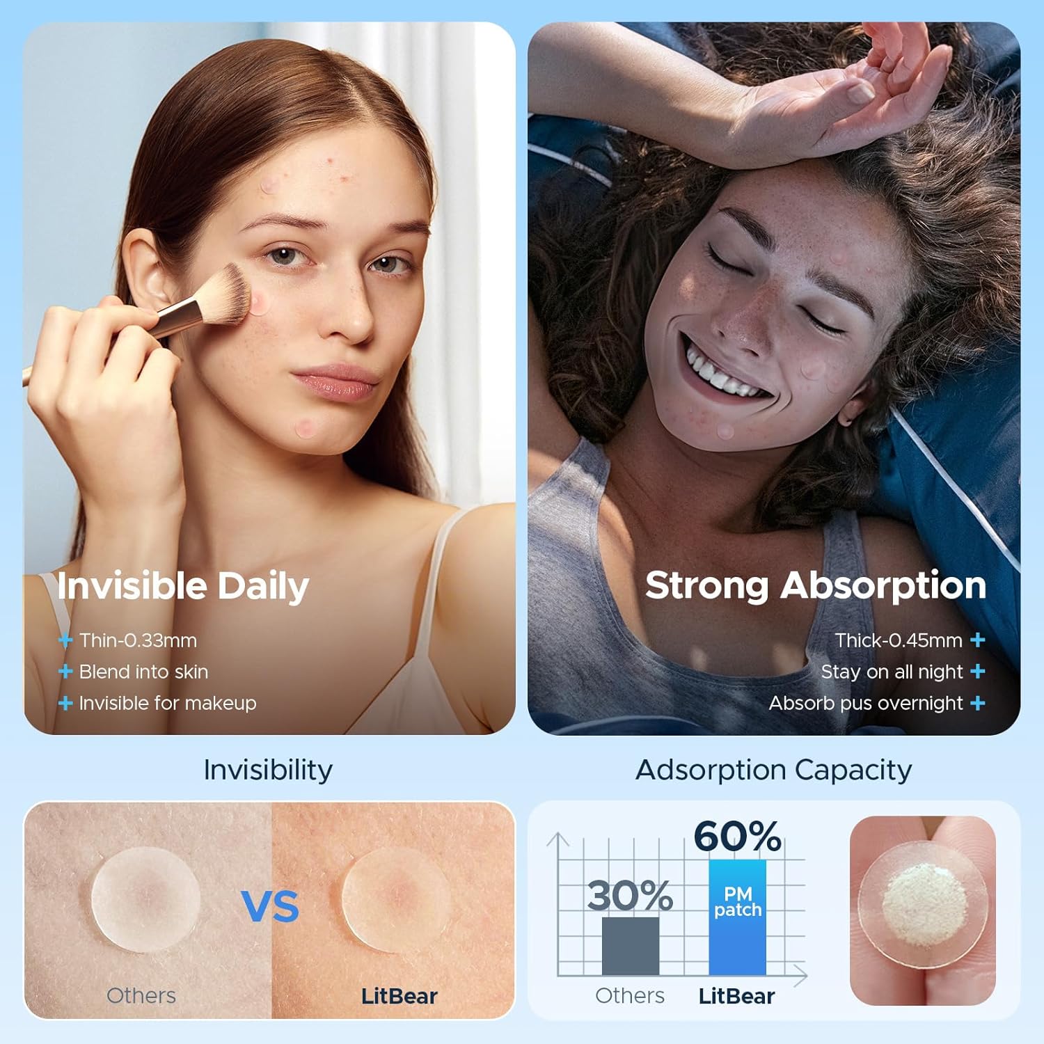 LitBear Pimple Patches for Face, 400 Counts Day and Night Acne Patches, Hydrocolloid Patches for Covering Zit and Blemishes, Large Breakouts, 5 Sizes Thin & Thick Spot Dots Stickers for Chin, Forehead