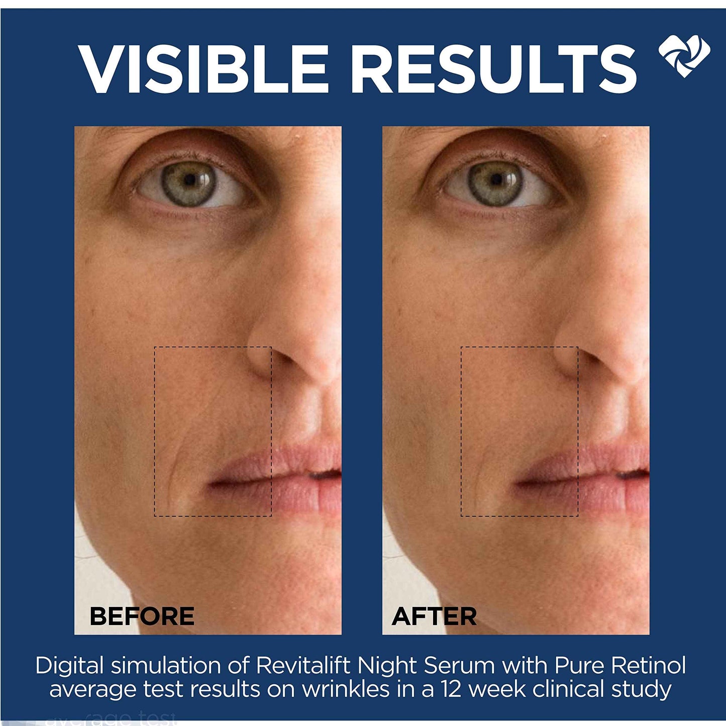 L'Oreal Paris Revitalift 0.3% Pure Retinol Night Serum, Reduce Deep Wrinkles, Fragrance Free 1 oz + Moisturizer Sample