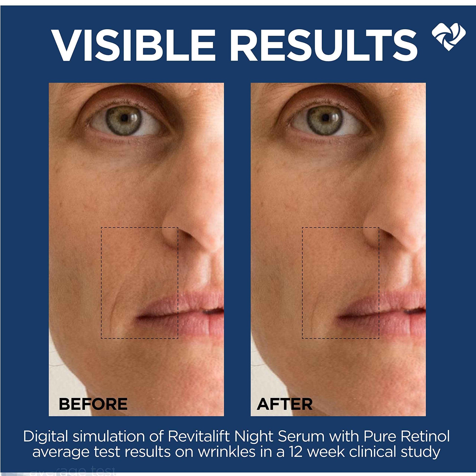 L'Oreal Paris Revitalift 0.3% Pure Retinol Night Serum, Reduce Deep Wrinkles, Fragrance Free 1 oz + Moisturizer Sample