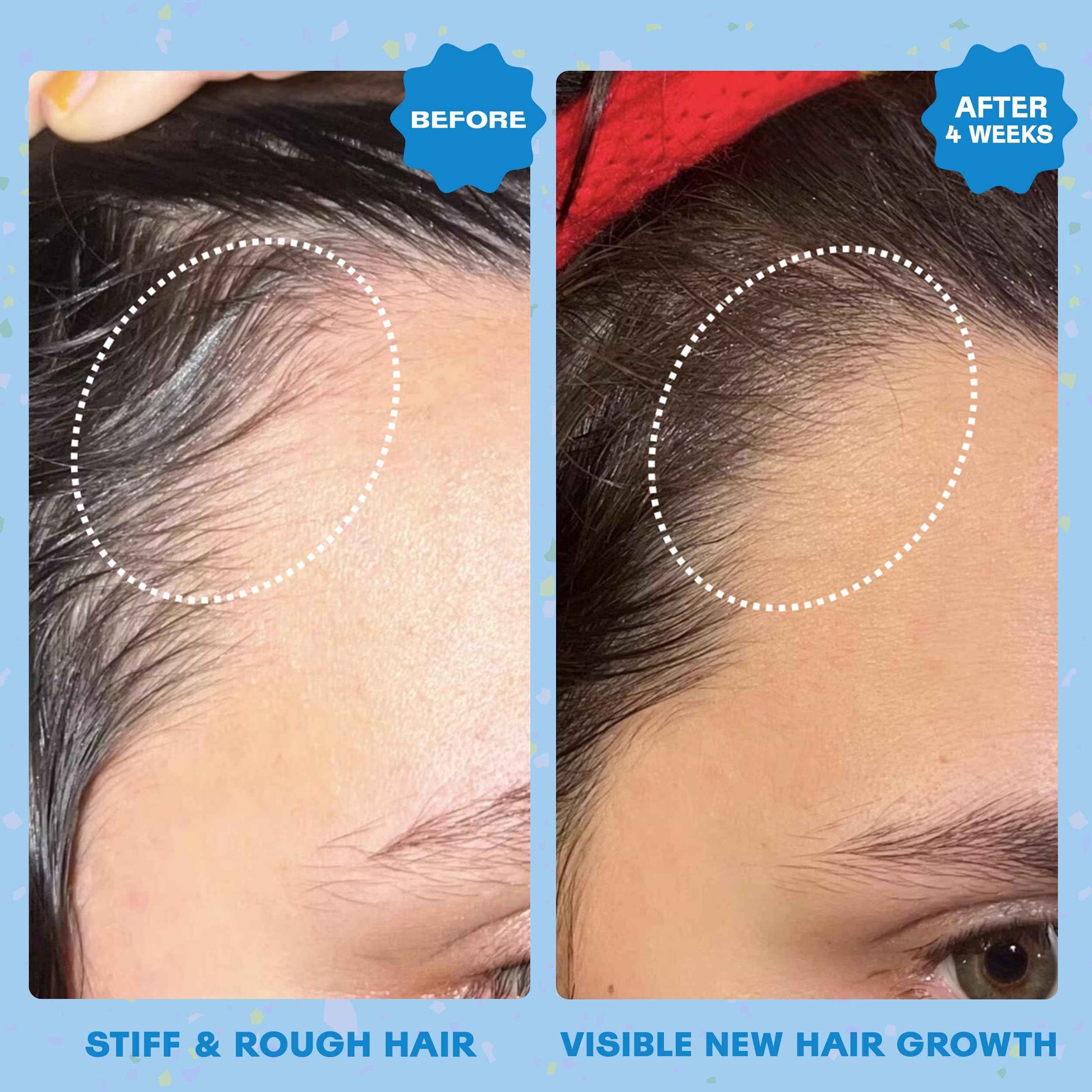 Squigs Hair Growth Oil for Dry & Damaged Hair – with Amla, Castor & Coconut Oil Blend for Frizz Control, Hydration & Scalp Treatment – Pre-Wash & Styling Treatment – 130ml