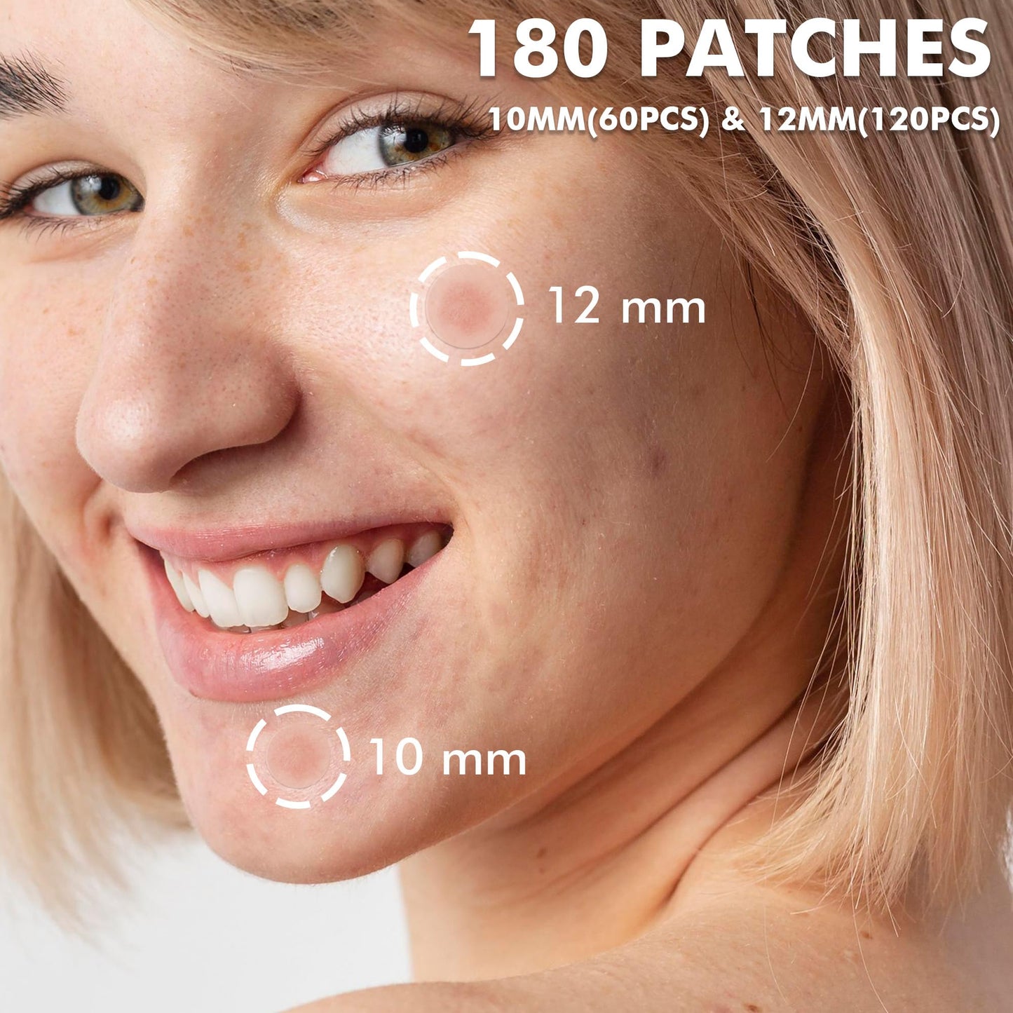 Invisible Acne Pimple Patches for Face (180 Counts), Spot Dots Cover by Albatross Health New England, Hydrocolloid Stickers, Zit Blemish Patch