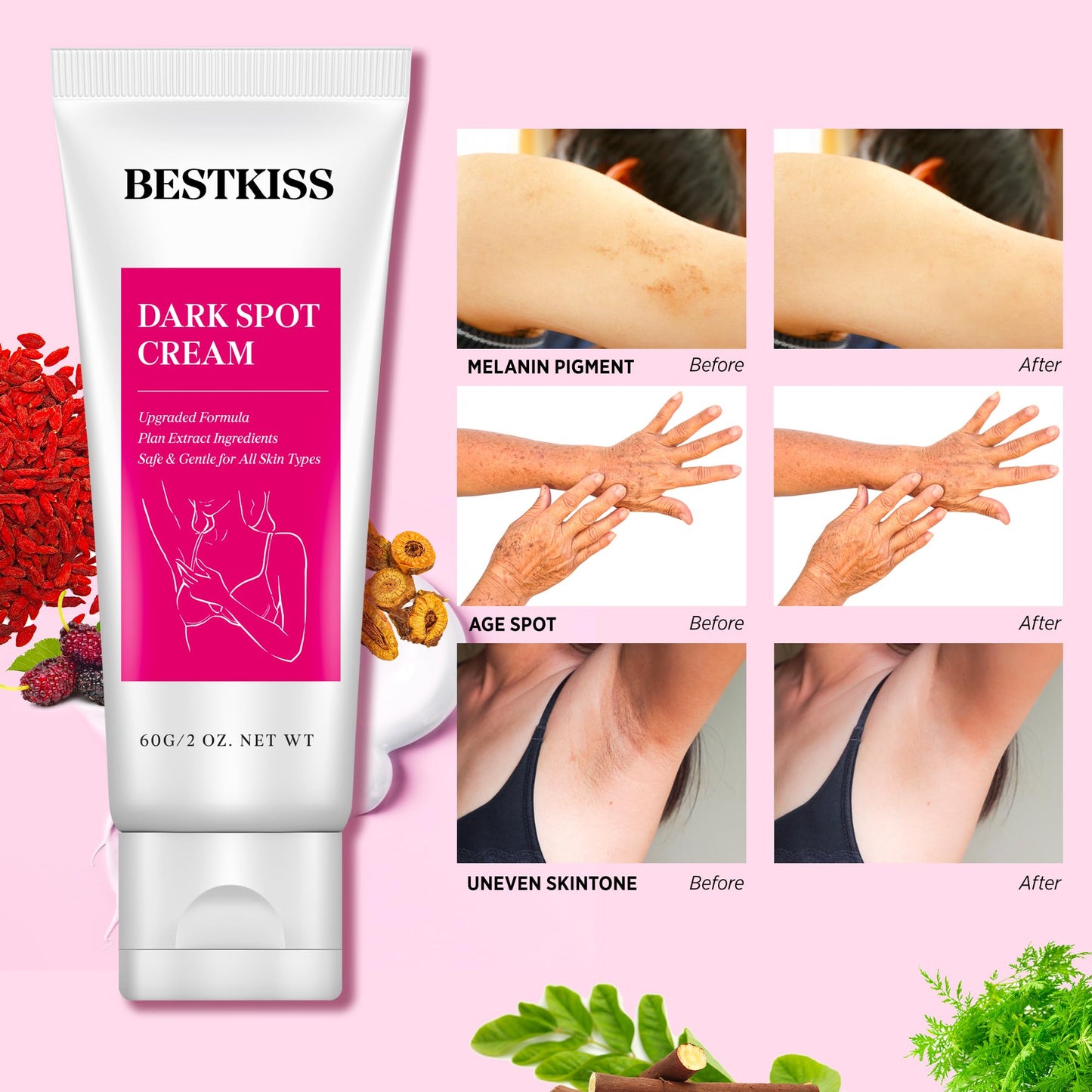 Bestkiss Dark Spot Corrector Cream: Dark Spot Remover for Body - Faded Spot Age Spot Melasma Correcting Brightening Moisturizer for Underarm Neck Bikini Area - Patented Skin Care Formula 60 g/2 OZ