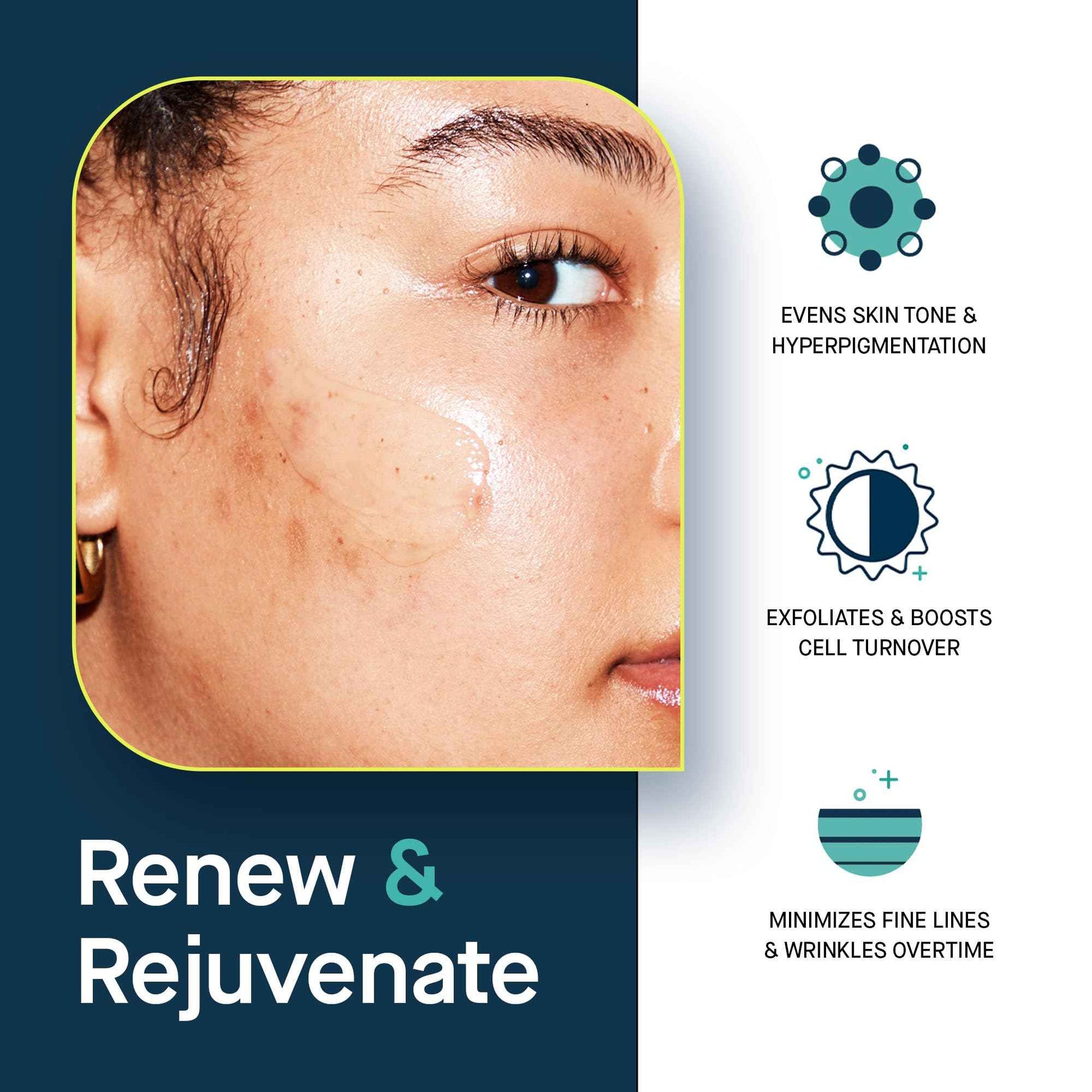 SLMD Resurfacing Retinol Serum with Vitamin C, Hyaluronic Acid & Allantoin | 1.5 fl oz | Retinol Face Serum, Clarifying Night Treatment for Fine Lines, Wrinkles, Dark Spots & Uneven Texture