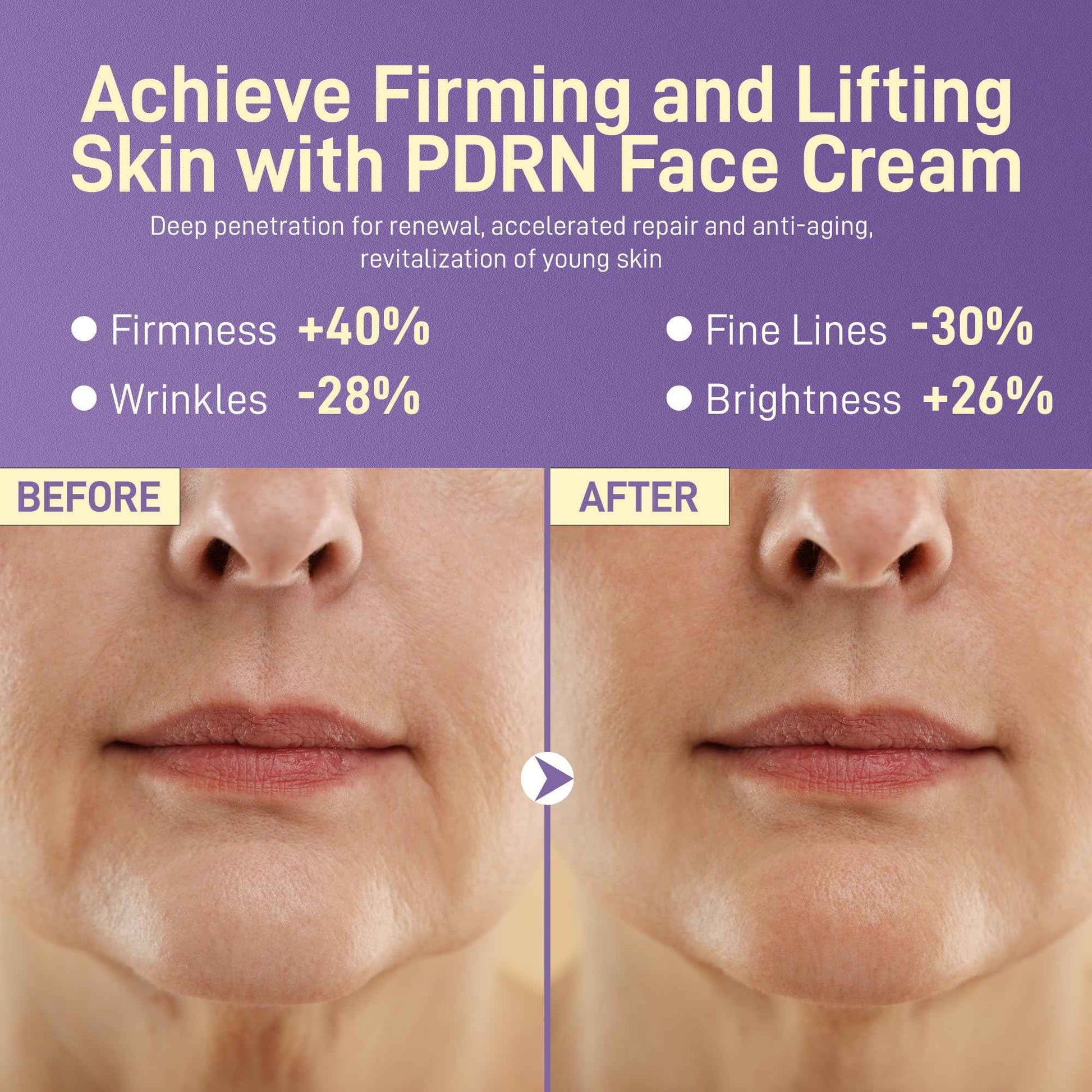 PDRN Anti-Aging Face Moisturizer Cream with 5% Squalane,100% Pure PDRN Salmon DNA,Hyaluronic Acid & B5, Firming, Hydrating, Moisturizing Repair Face & Neck Skincare Cream for All Skin,1.85 Fl Oz