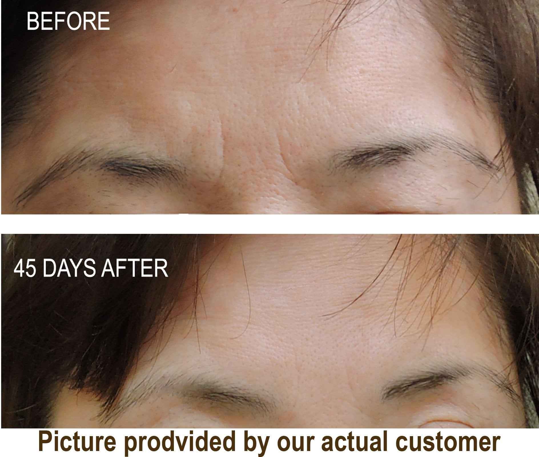 DNA Code®-No Needle Alternative-Argireline Copper Peptide Wrinkle Reduce Serum Booster w/Snap-8, Matrixyl 3000