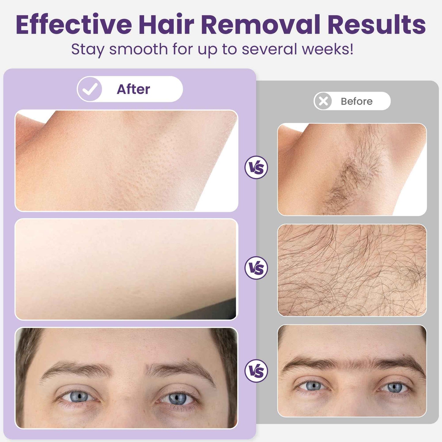 Sunvivi Waxing Kit, Brazilian Wax Warmer for Hair Removal with 5 Bag Hard Wax Beads, Digital Display Melt Warmer Kit for Women Men Full Body, Legs, Face, Bikini,Sensitive skin, Pink